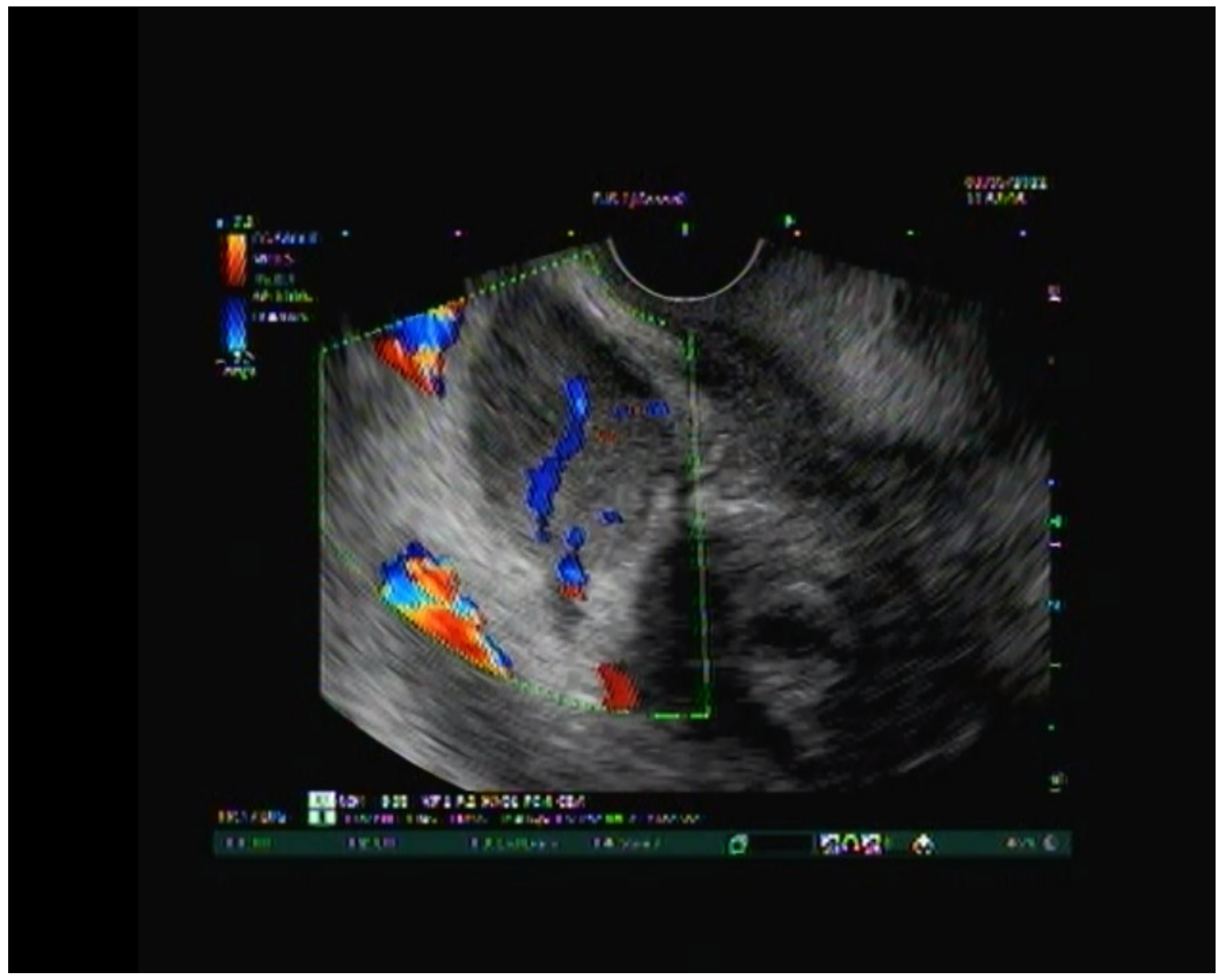 Diagnostics 13 00866 g005 Diagnostics 13 00866 g005