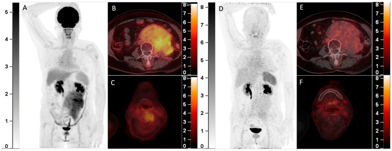 Diagnostics 13 00871 g002