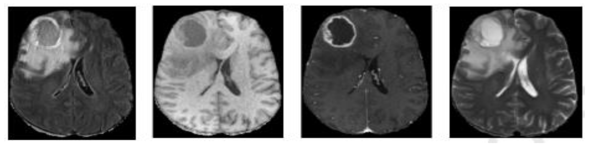 Diagnostics 13 00872 g001 Diagnostics 13 00872 g001