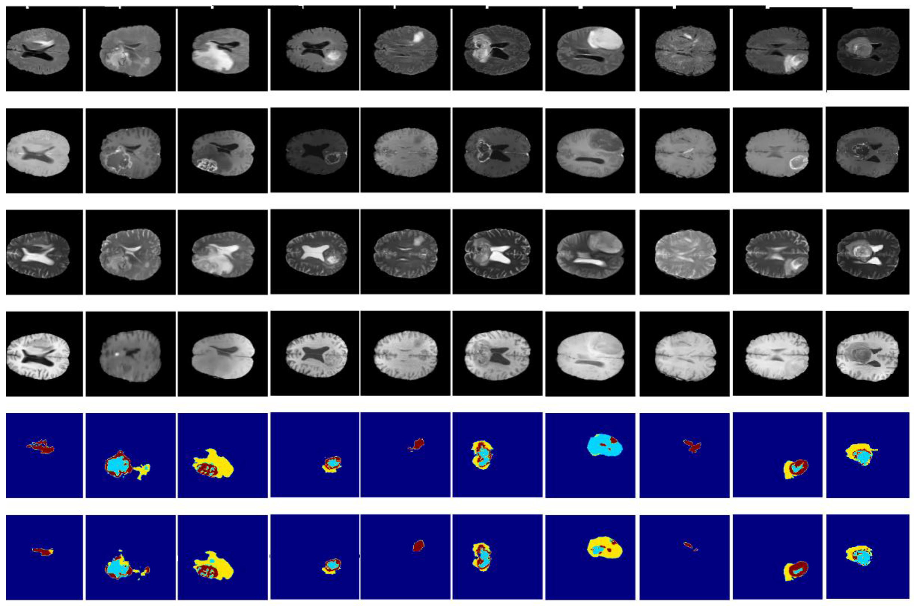 Diagnostics 13 00872 g014 Diagnostics 13 00872 g014