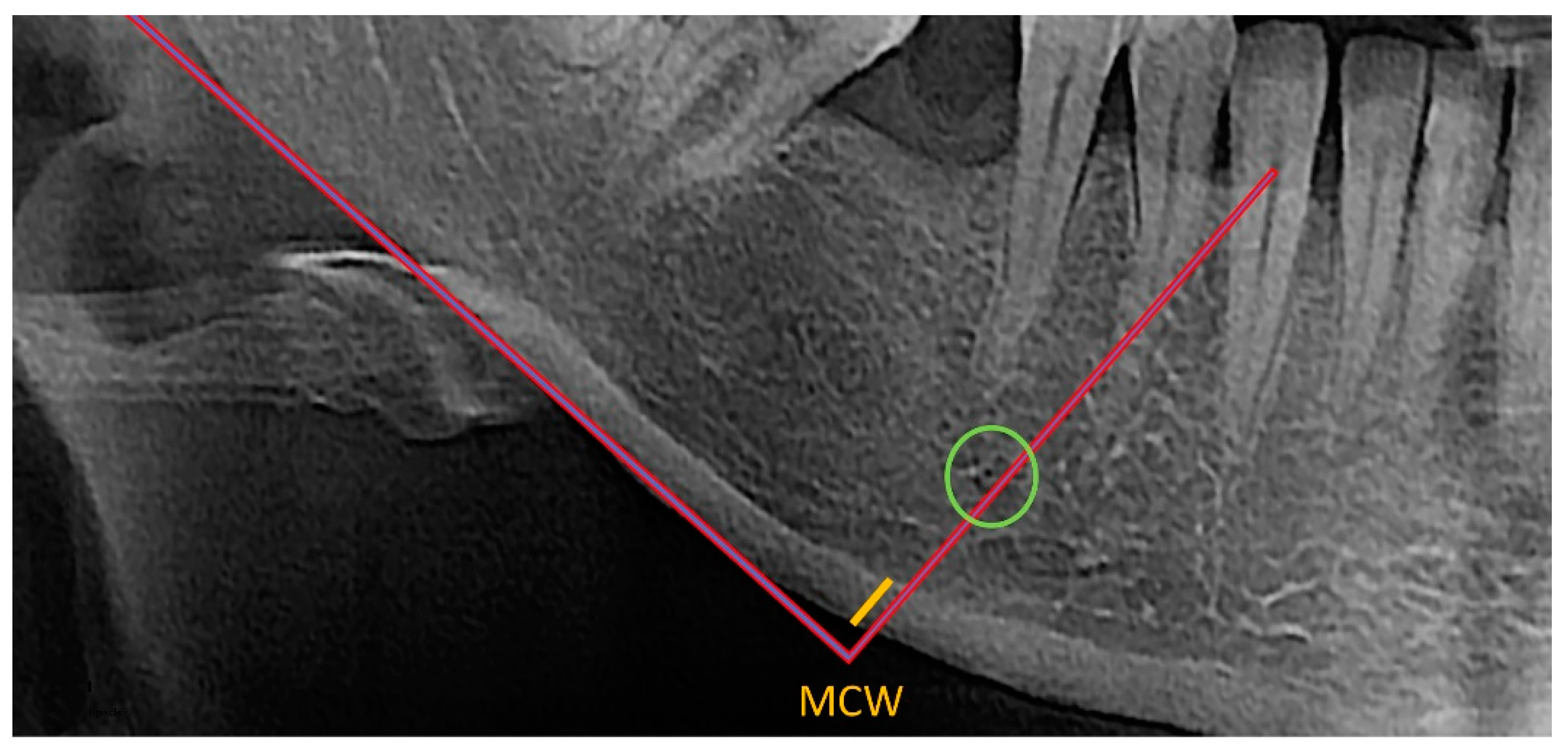 Diagnostics 13 00881 g001