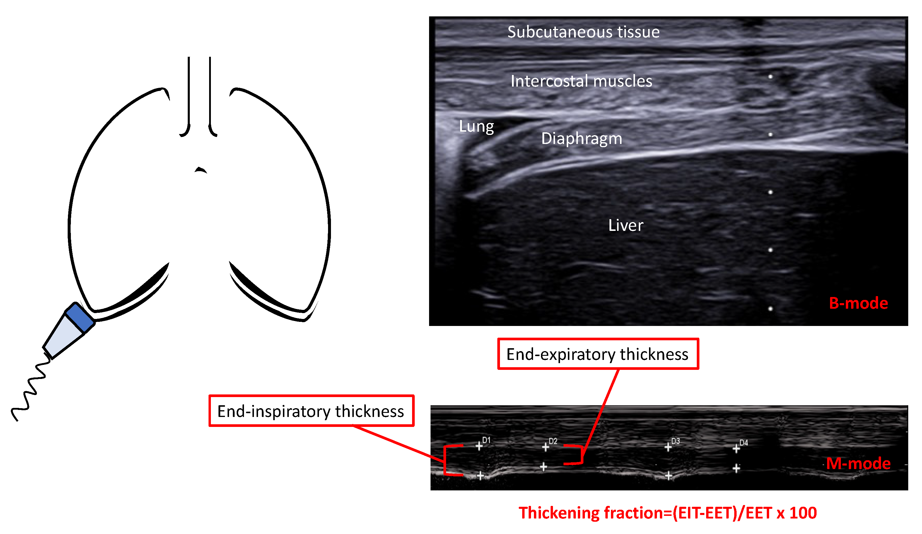 Diagnostics 13 00888 g002 Diagnostics 13 00888 g002