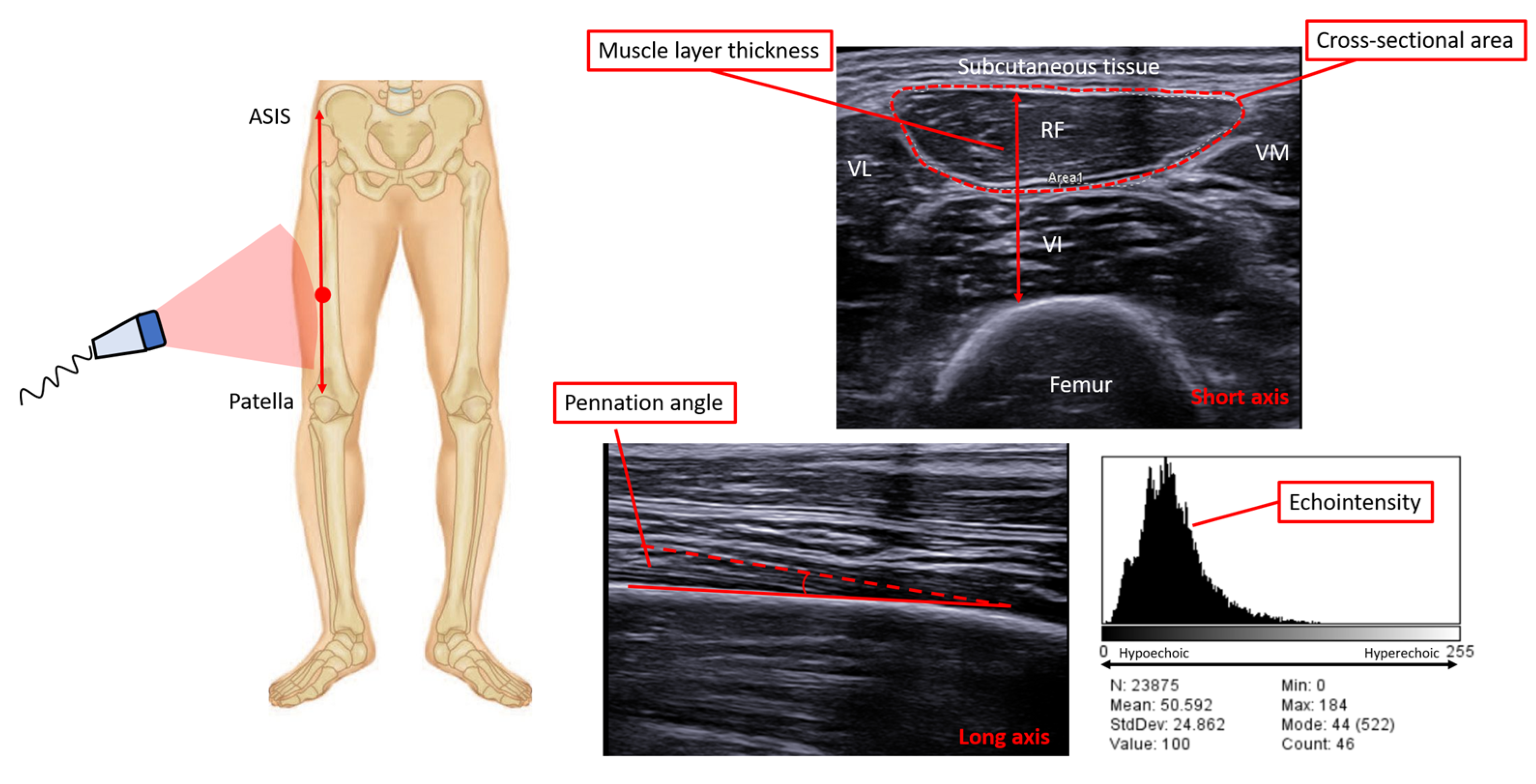 Diagnostics 13 00888 g004 Diagnostics 13 00888 g004
