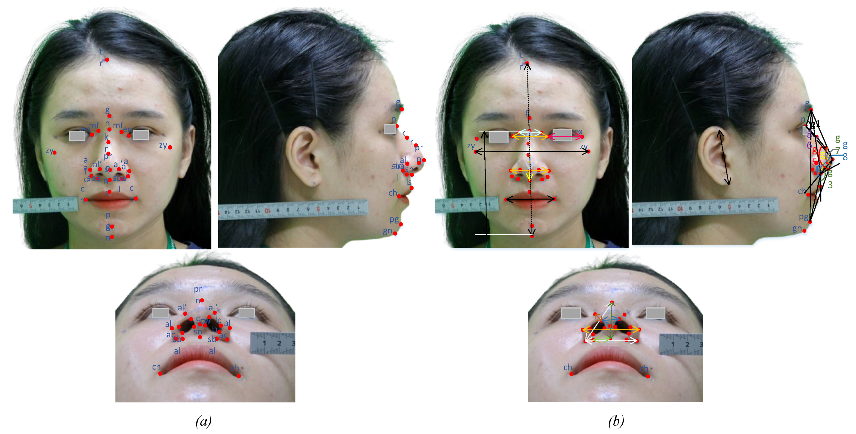 Diagnostics 13 00891 g007 Diagnostics 13 00891 g007