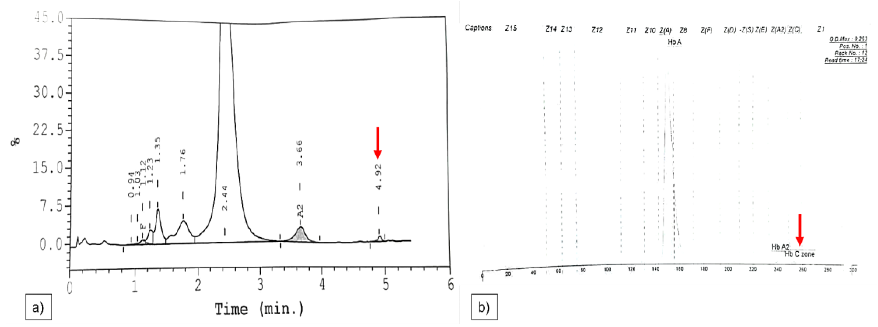 Diagnostics 13 00894 g003