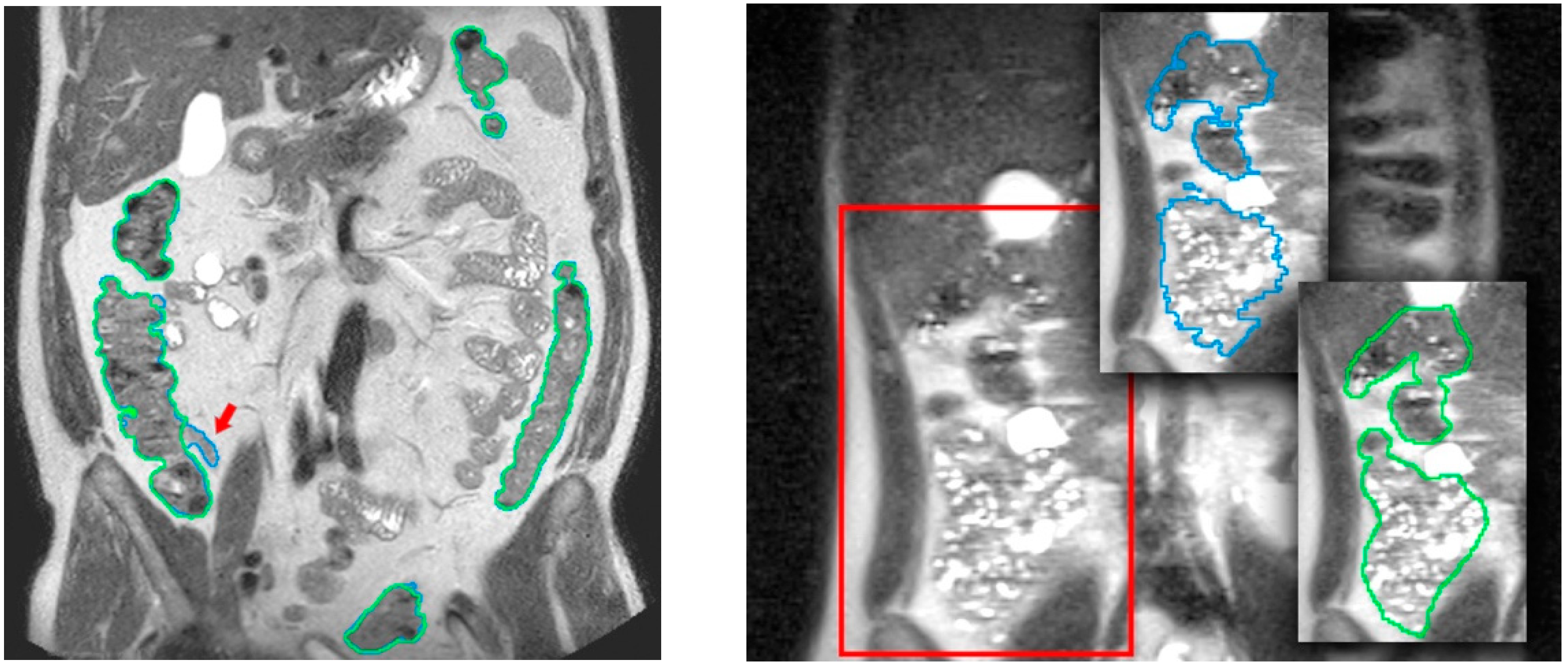 Diagnostics 13 00910 g004