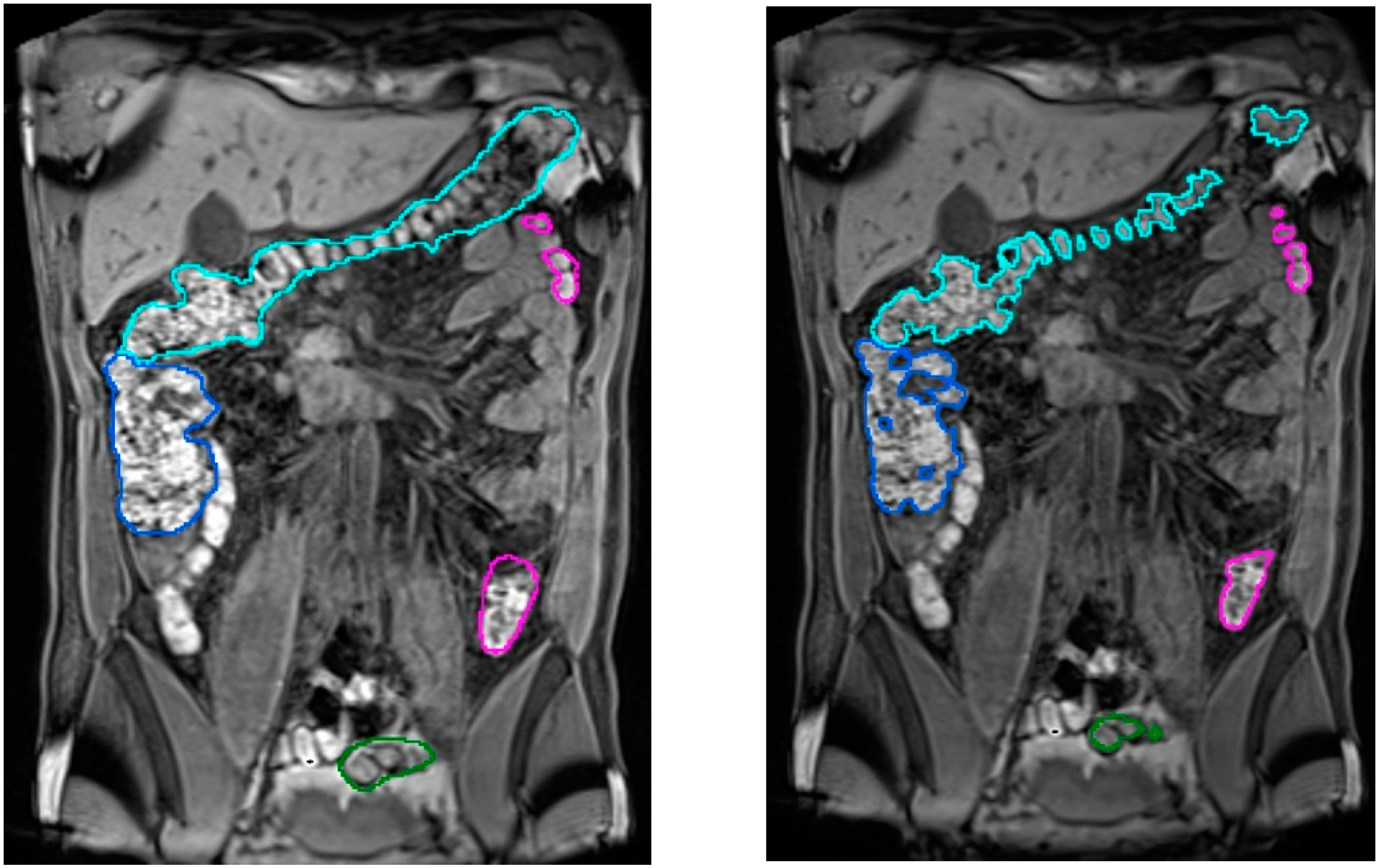Diagnostics 13 00910 g005