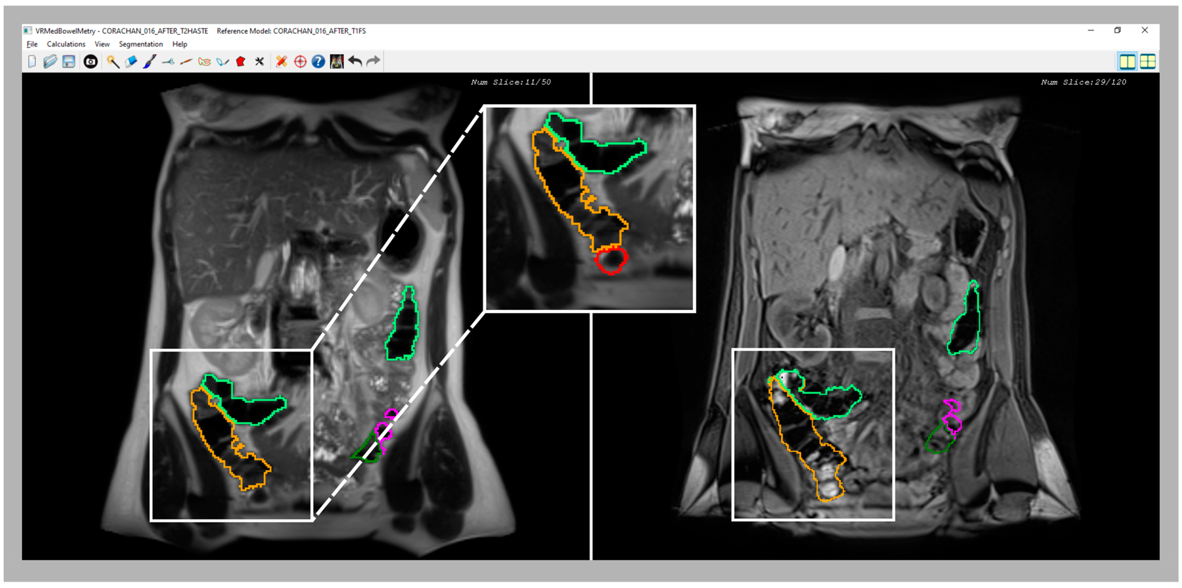 Diagnostics 13 00910 g006
