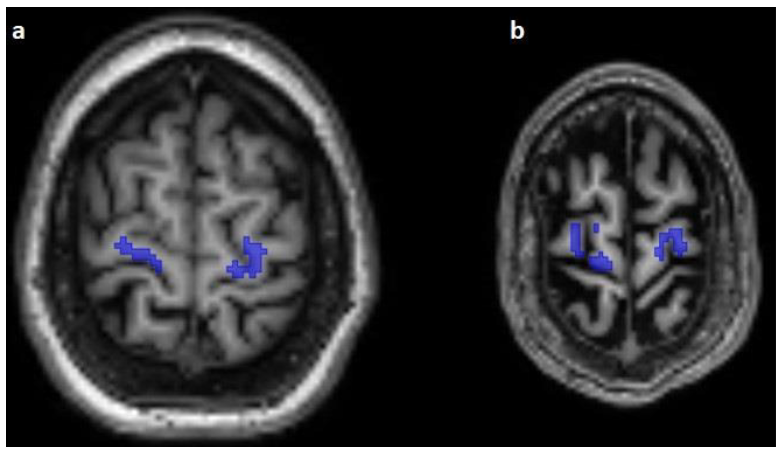 Diagnostics 13 00911 g003 Diagnostics 13 00911 g003