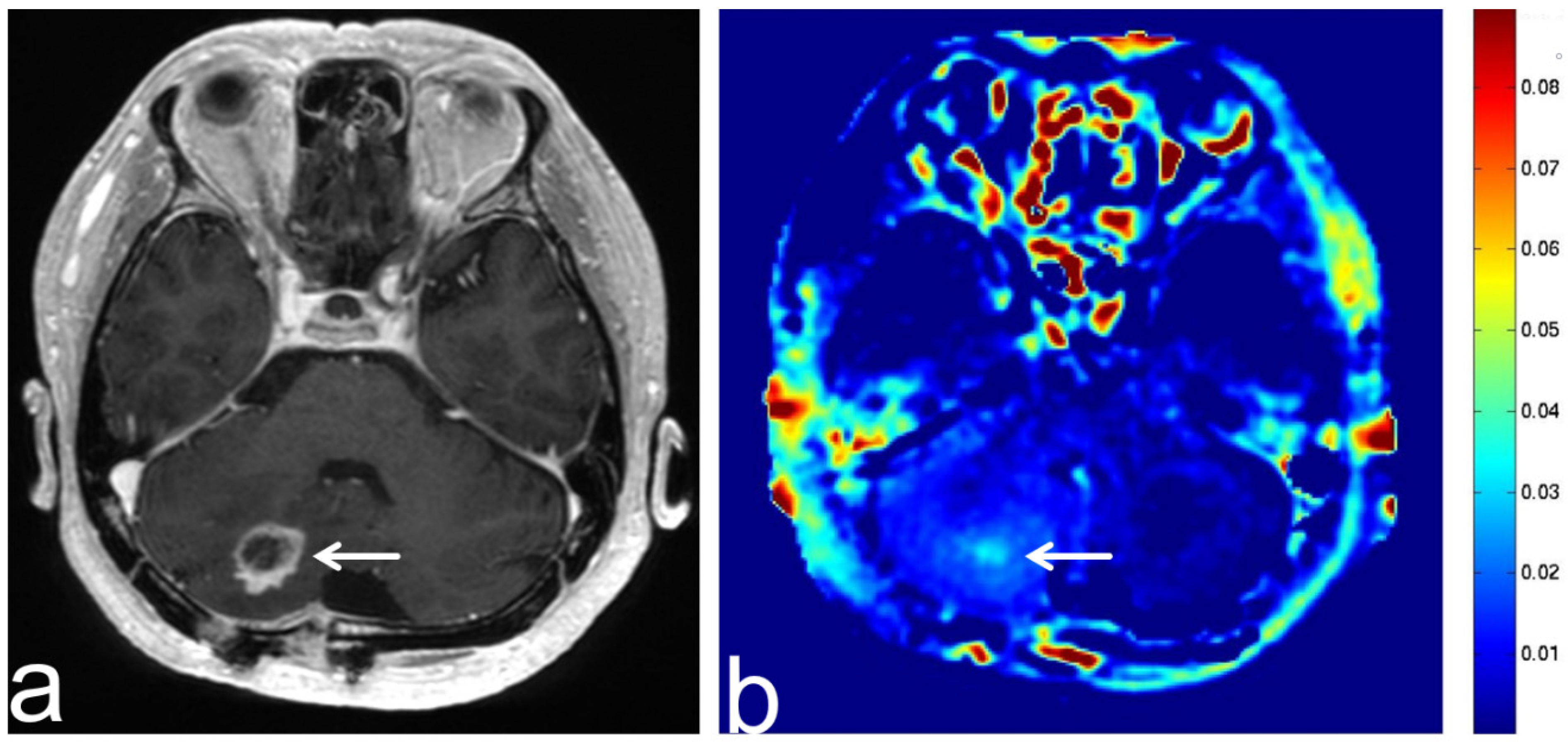 Diagnostics 13 00914 g003