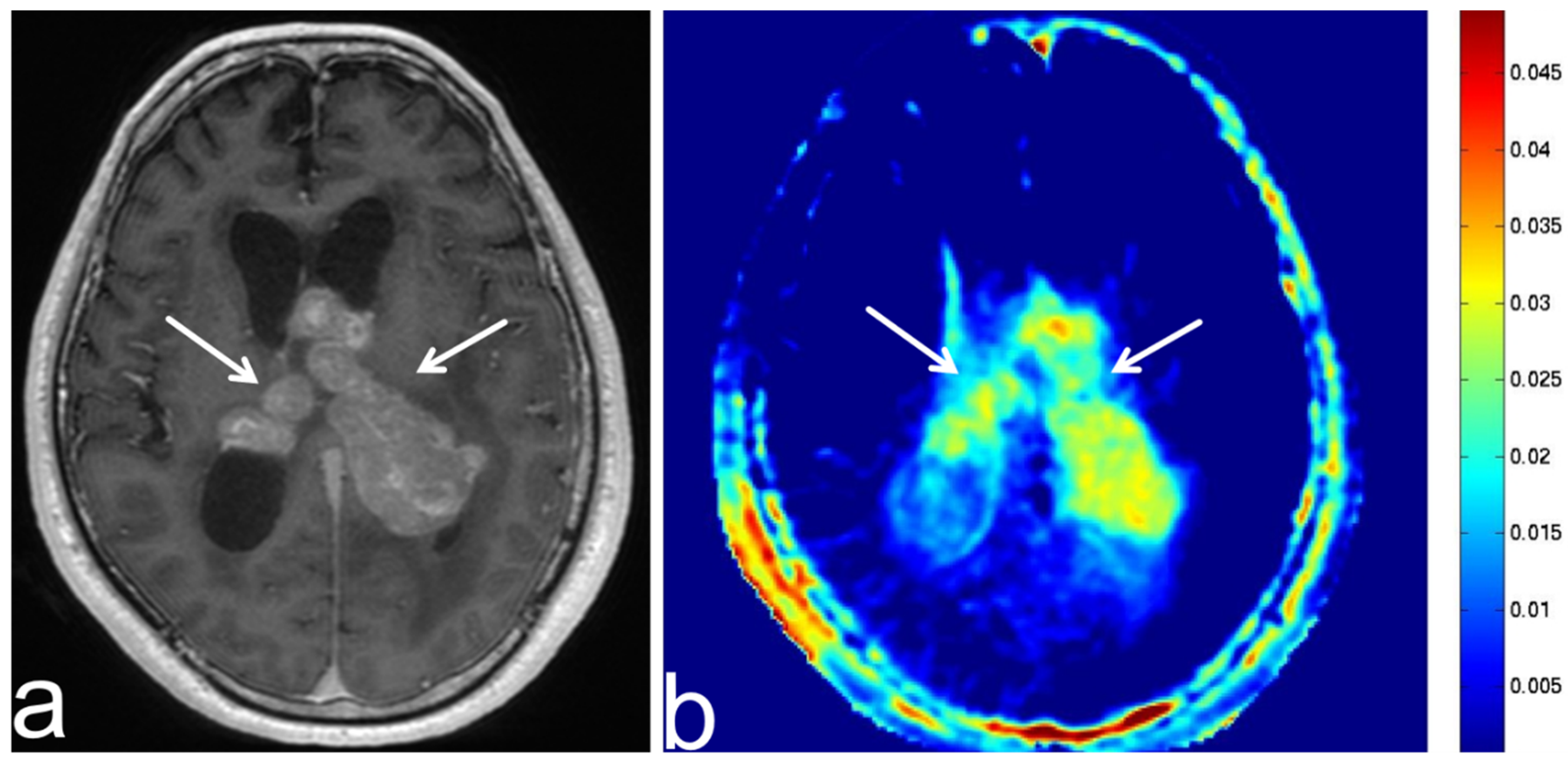Diagnostics 13 00914 g006