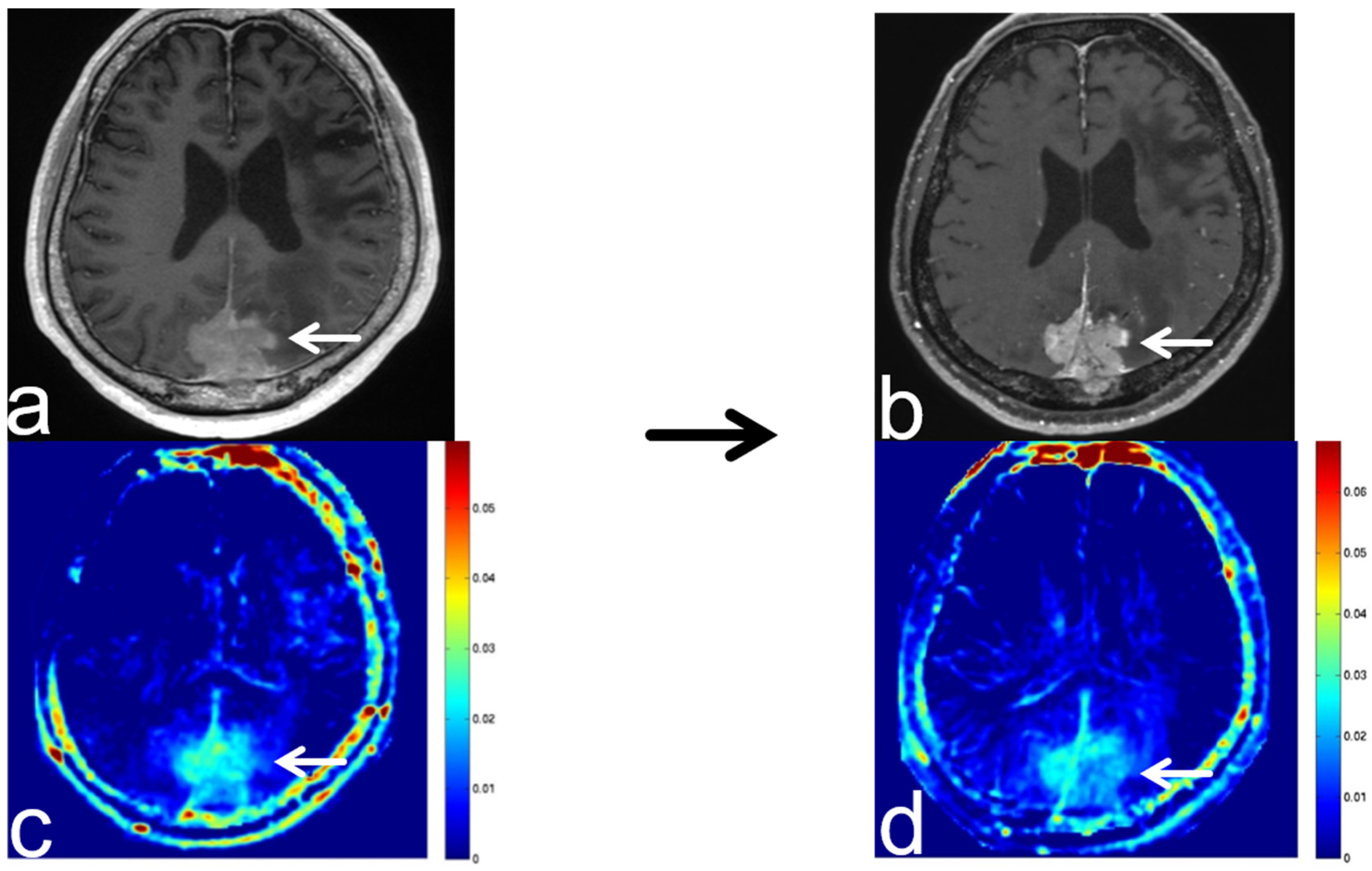 Diagnostics 13 00914 g008