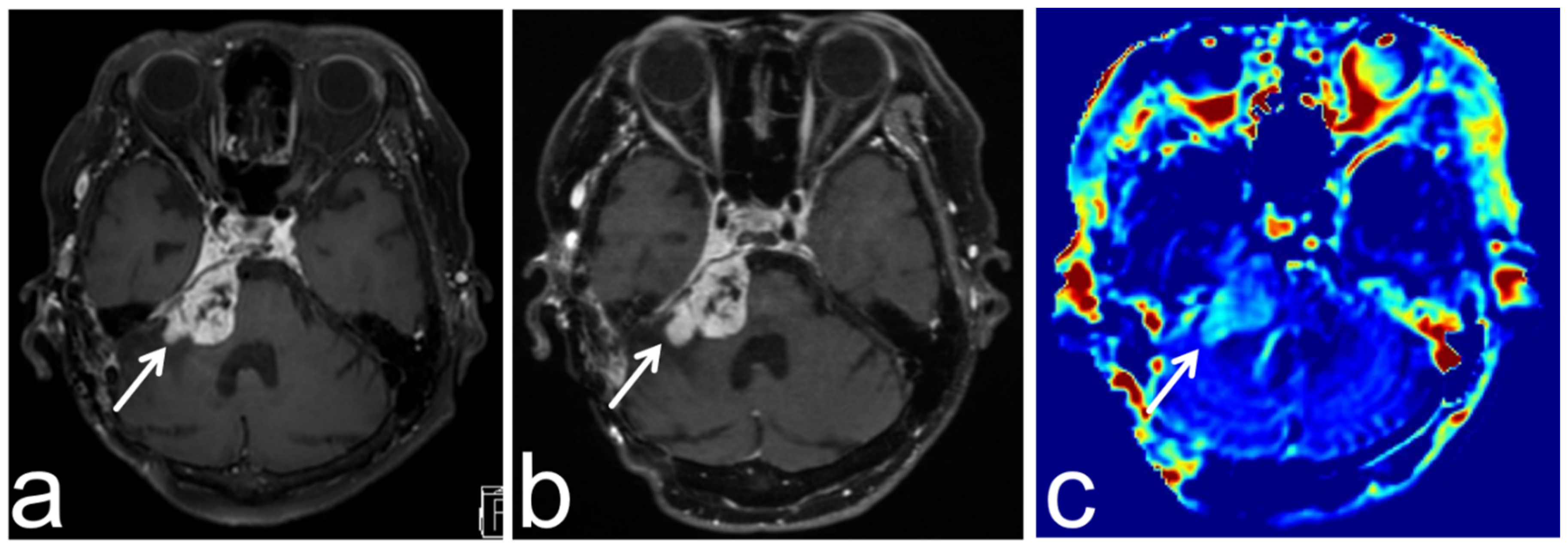 Diagnostics 13 00914 g011