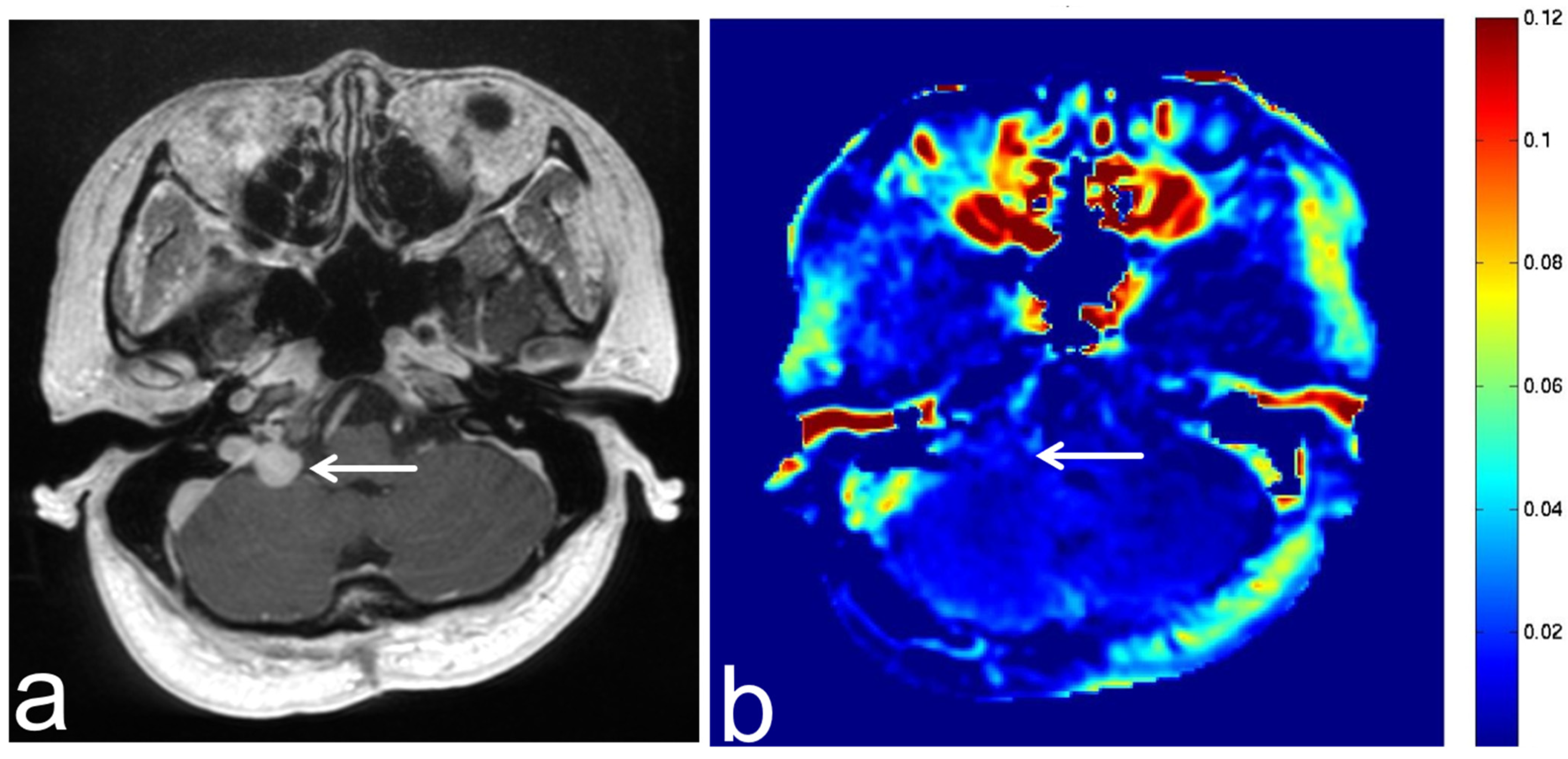 Diagnostics 13 00914 g013