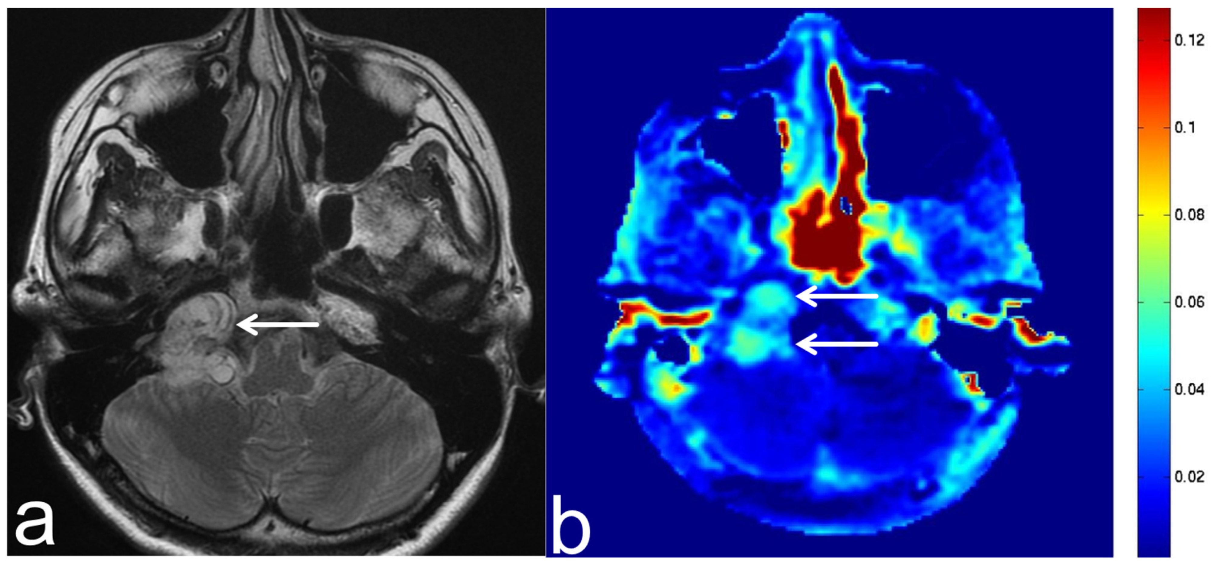 Diagnostics 13 00914 g014