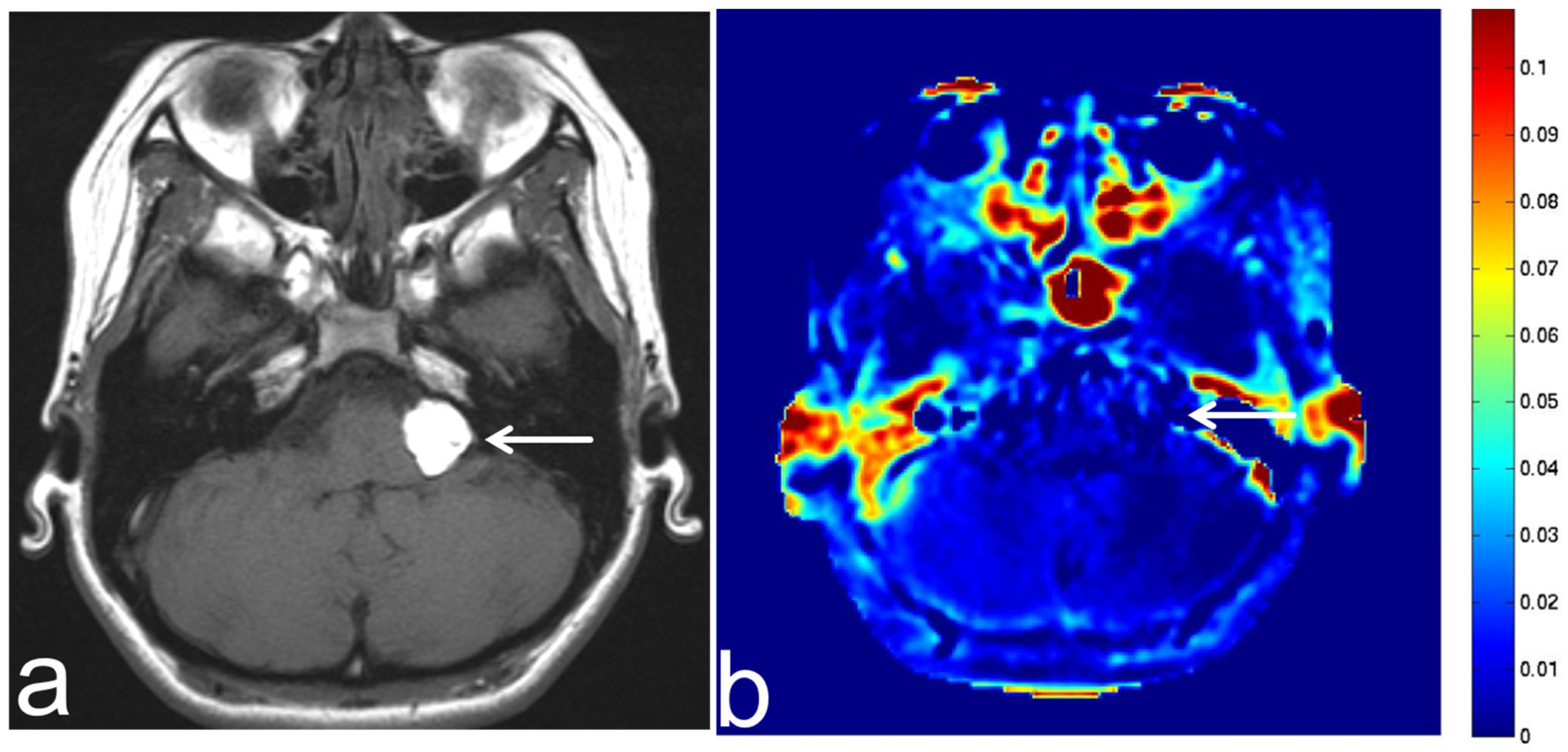 Diagnostics 13 00914 g015