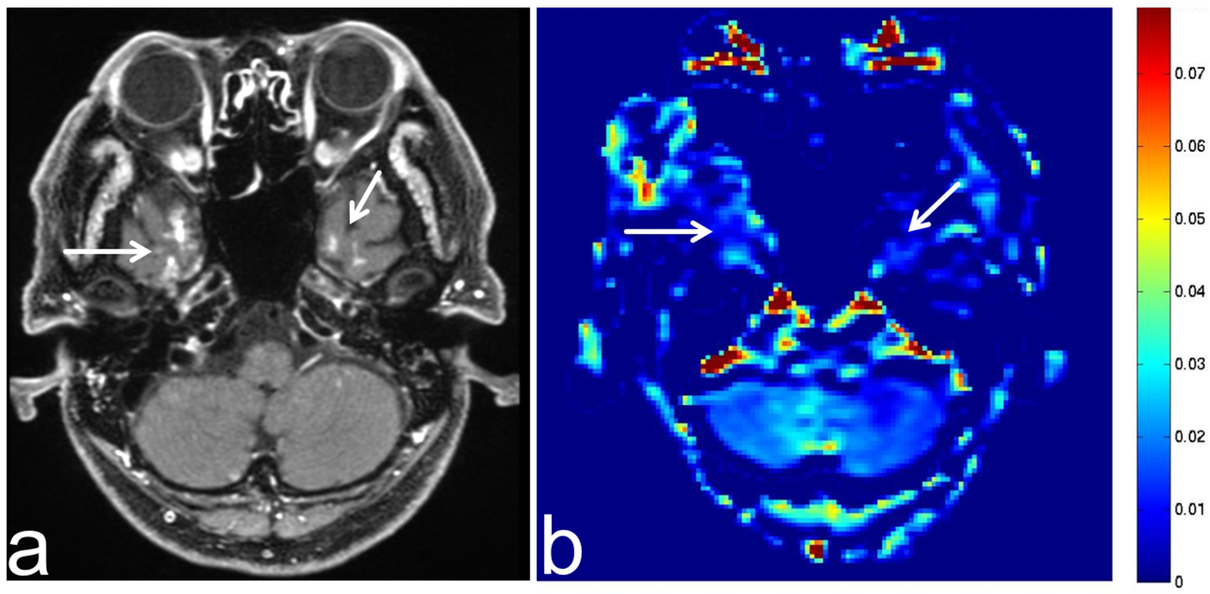 Diagnostics 13 00914 g016