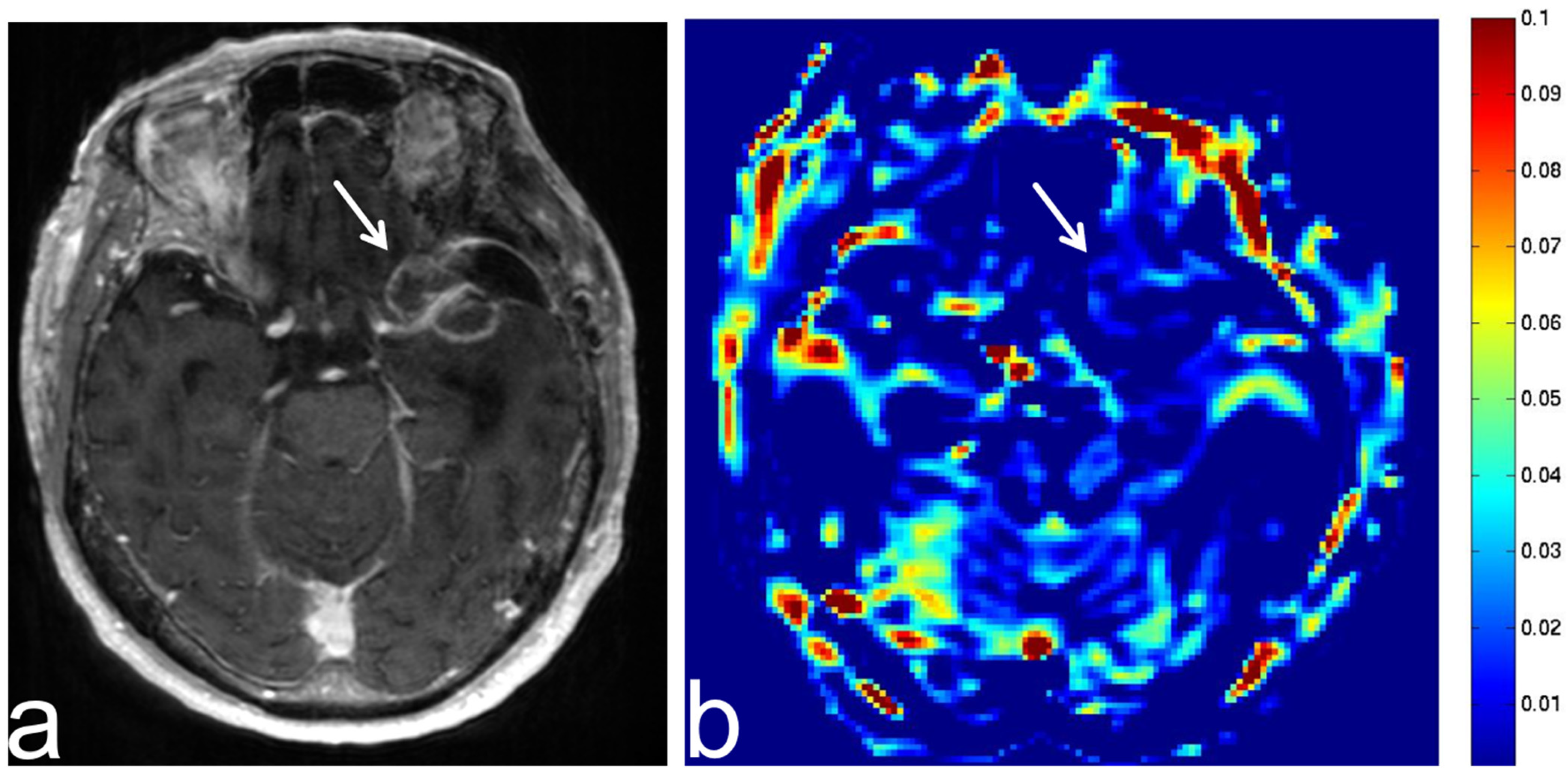 Diagnostics 13 00914 g017