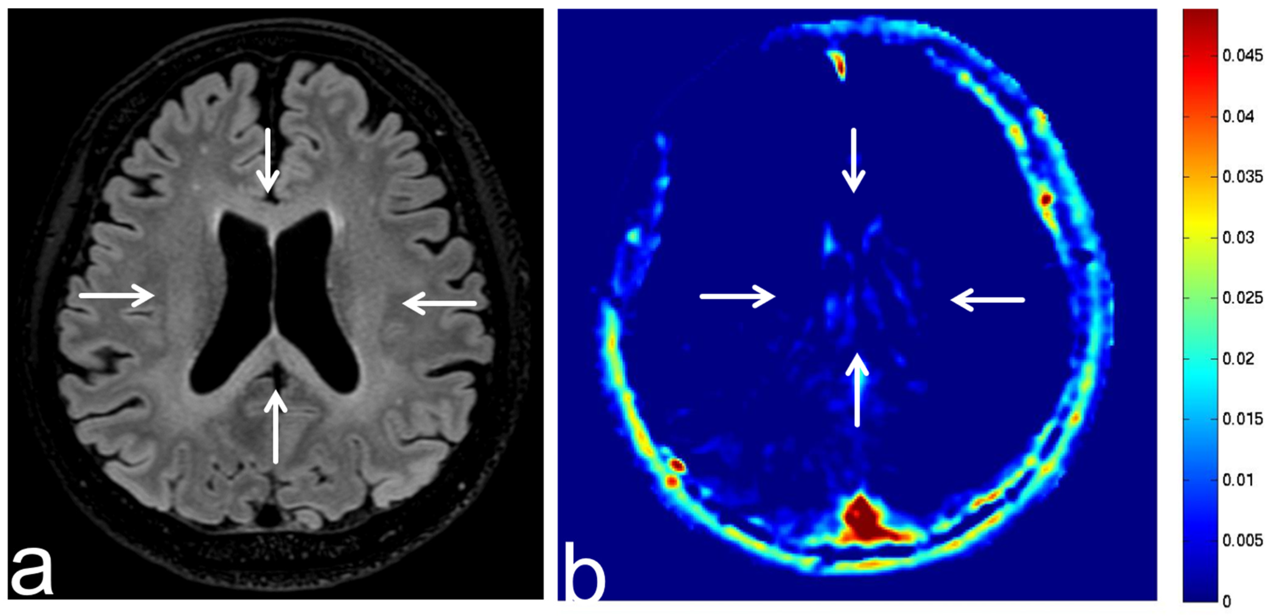 Diagnostics 13 00914 g018