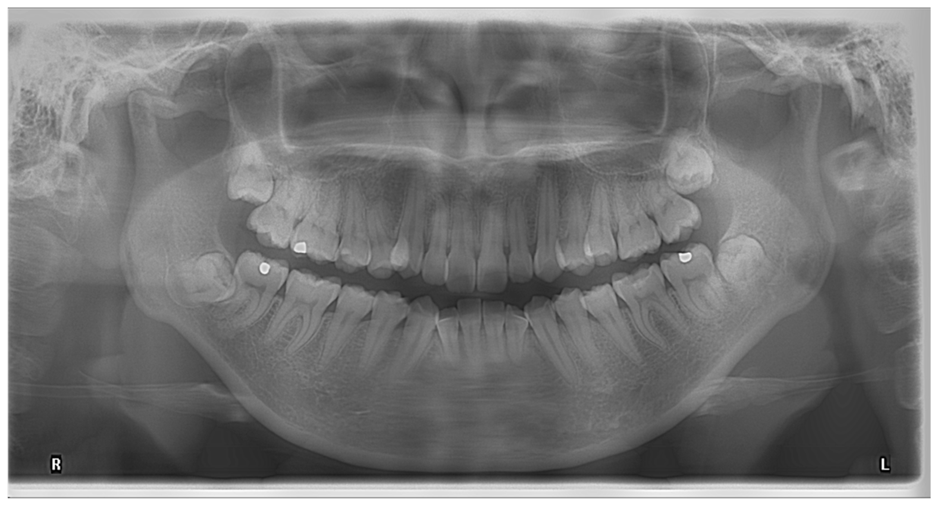 Diagnostics free full text application of cone beam computed