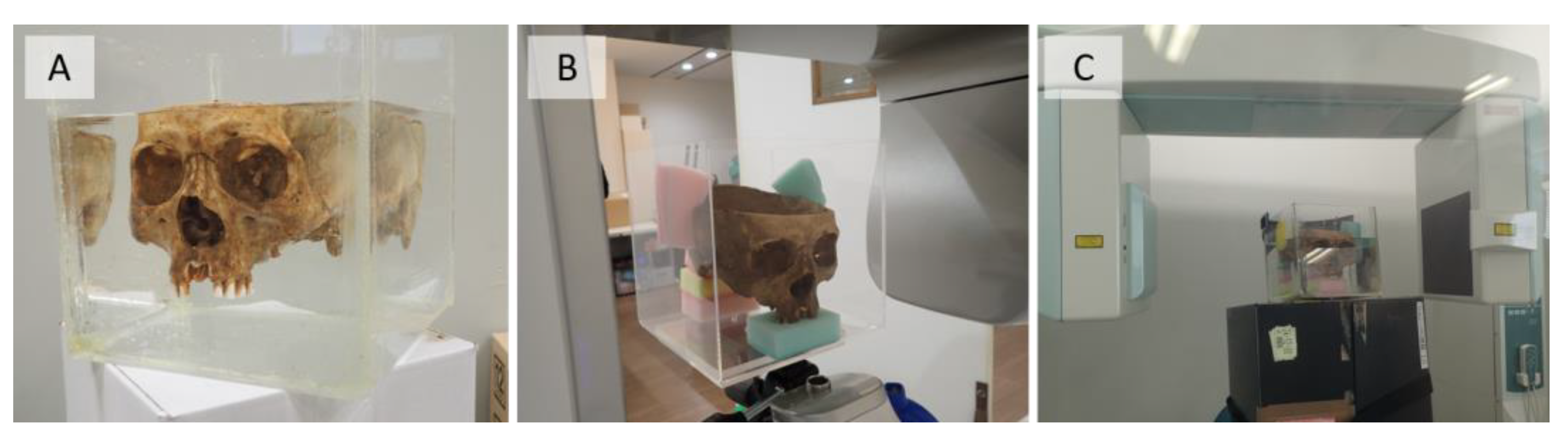 Diagnostics 13 00921 g001 Diagnostics 13 00921 g001