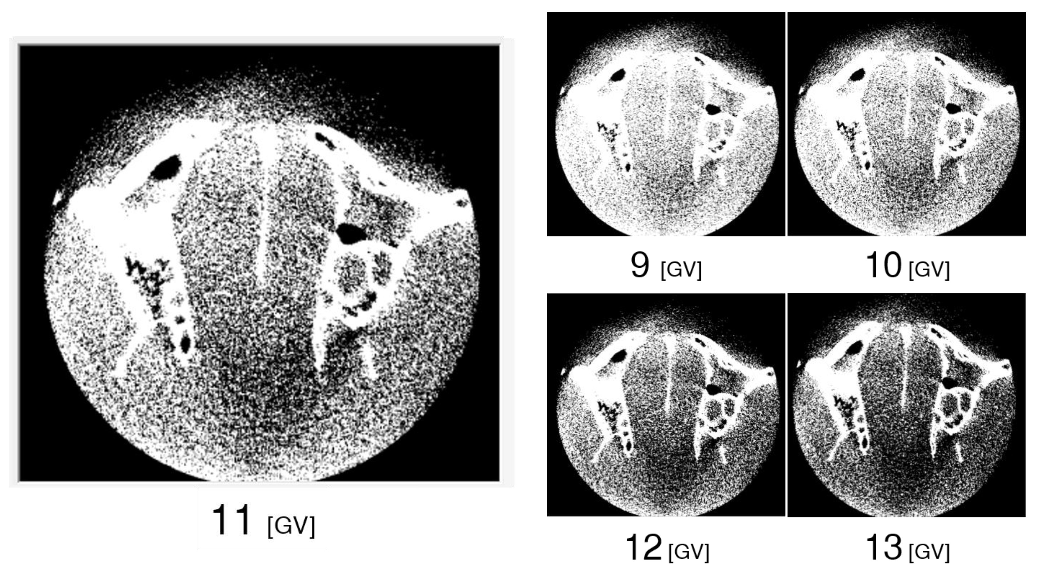 Diagnostics 13 00921 g005 Diagnostics 13 00921 g005