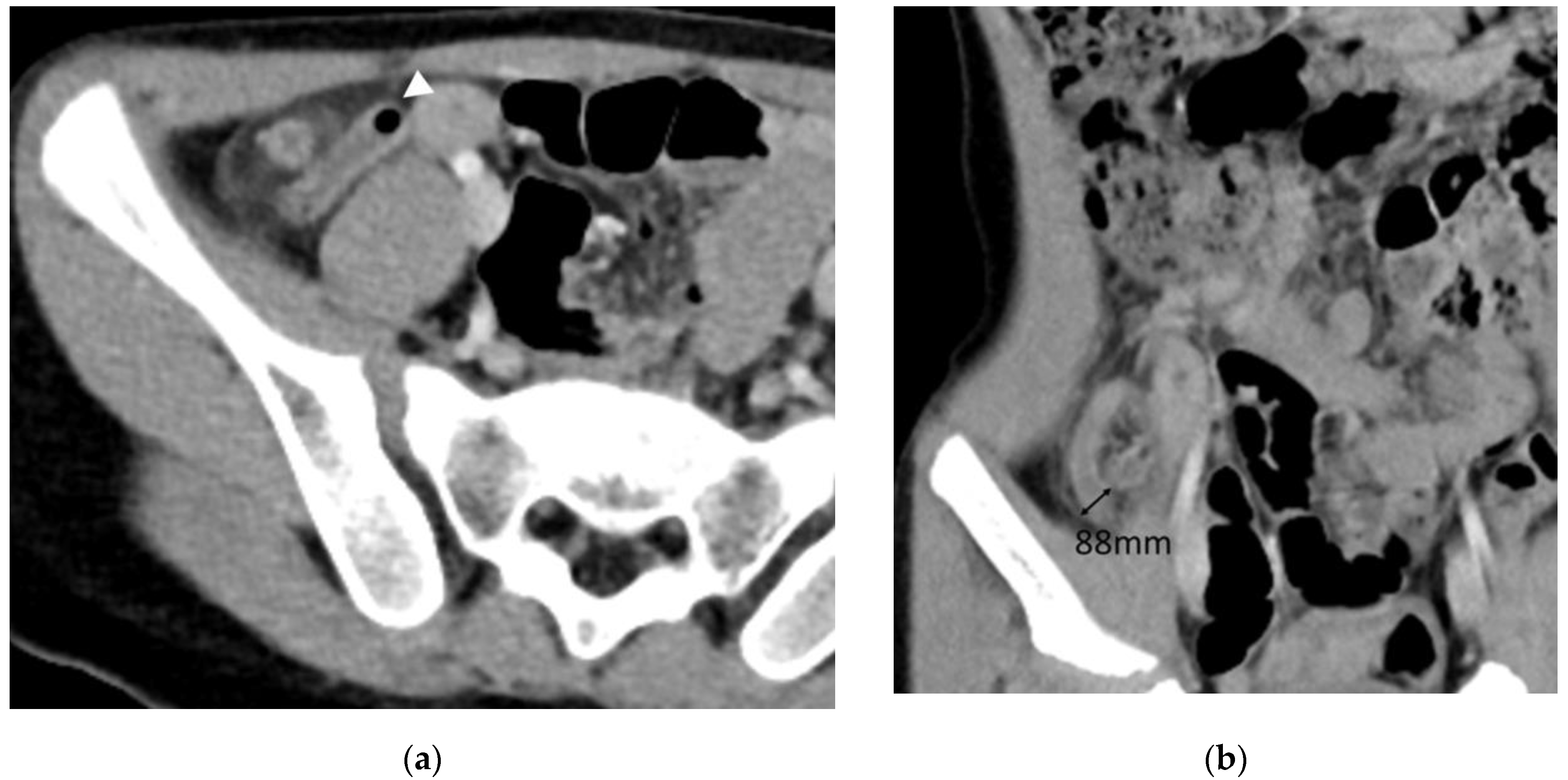 Diagnostics Free FullText Diagnostic Algorithm Based on Machine Learning to Predict