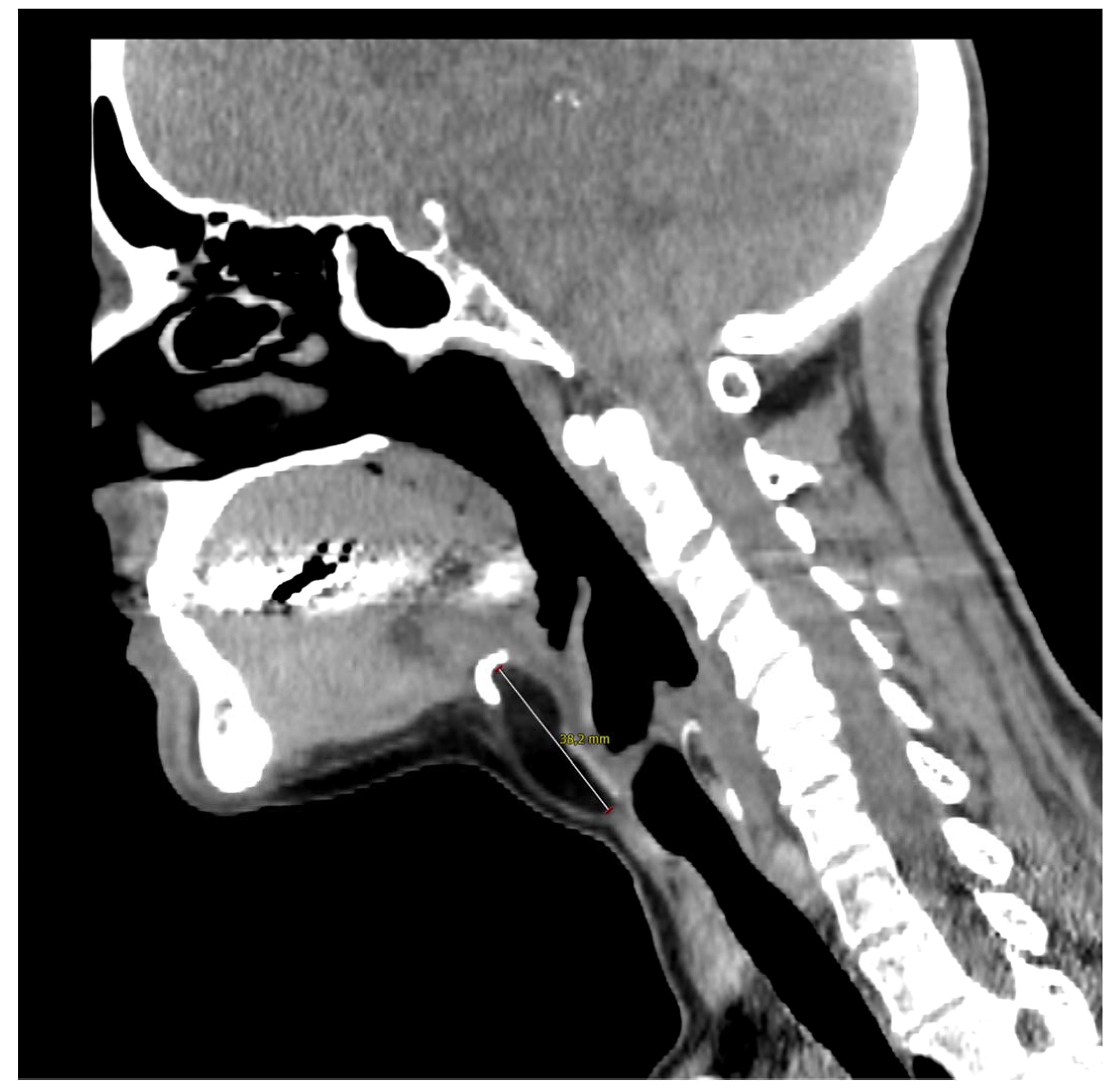 Diagnostics 13 00932 g002 Diagnostics 13 00932 g002
