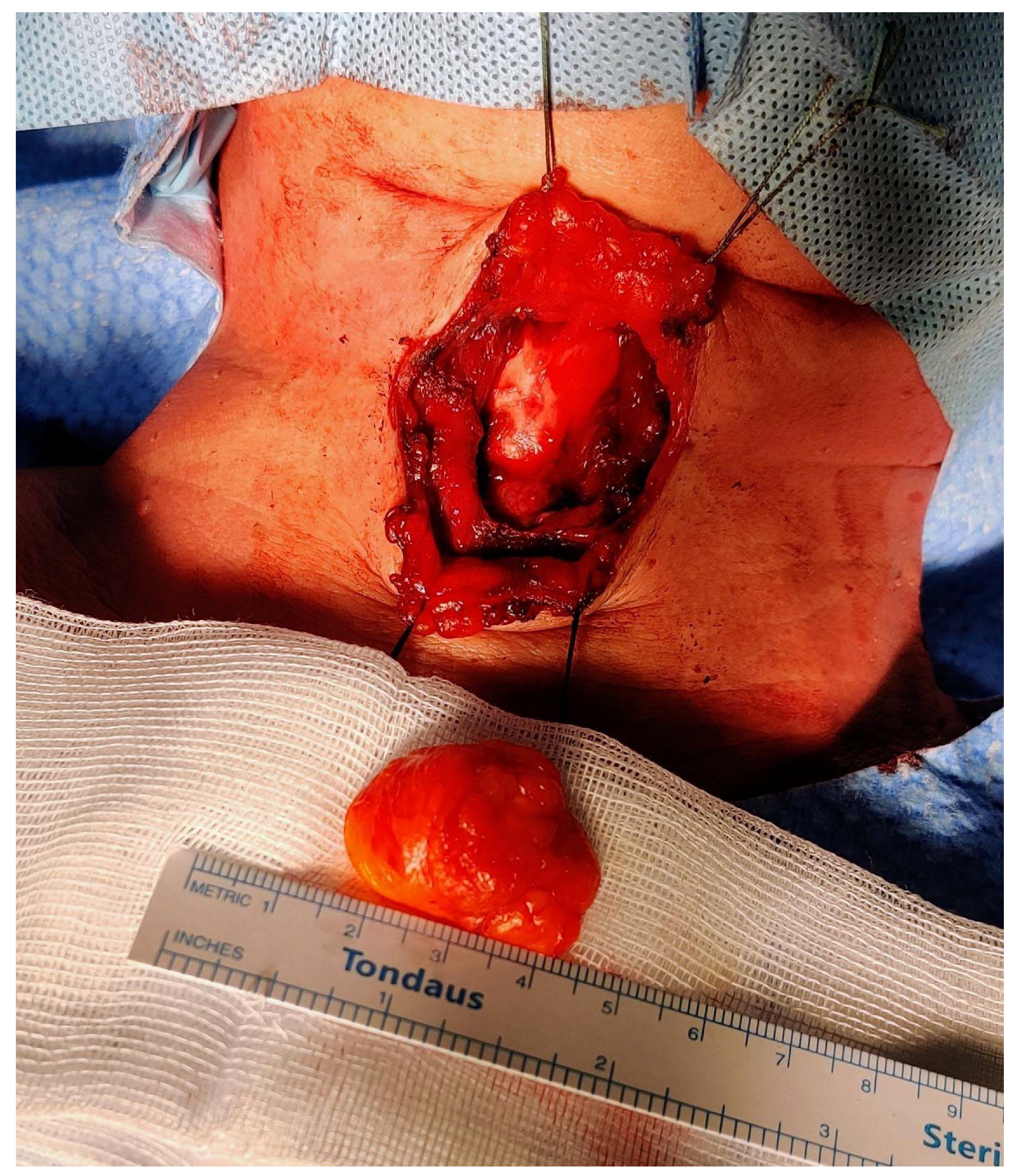 Diagnostics 13 00932 g005 Diagnostics 13 00932 g005