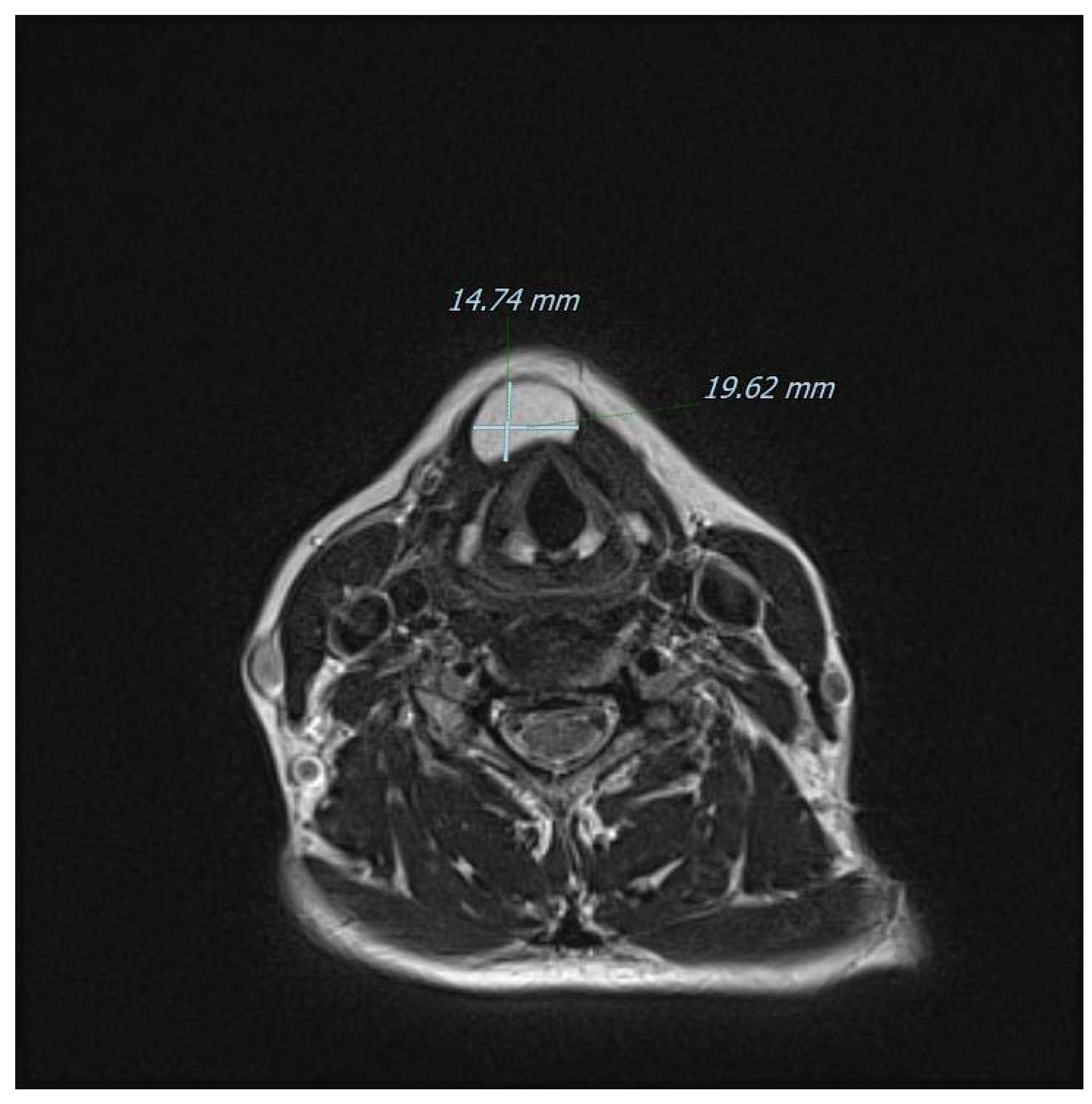 Diagnostics 13 00932 g006 Diagnostics 13 00932 g006