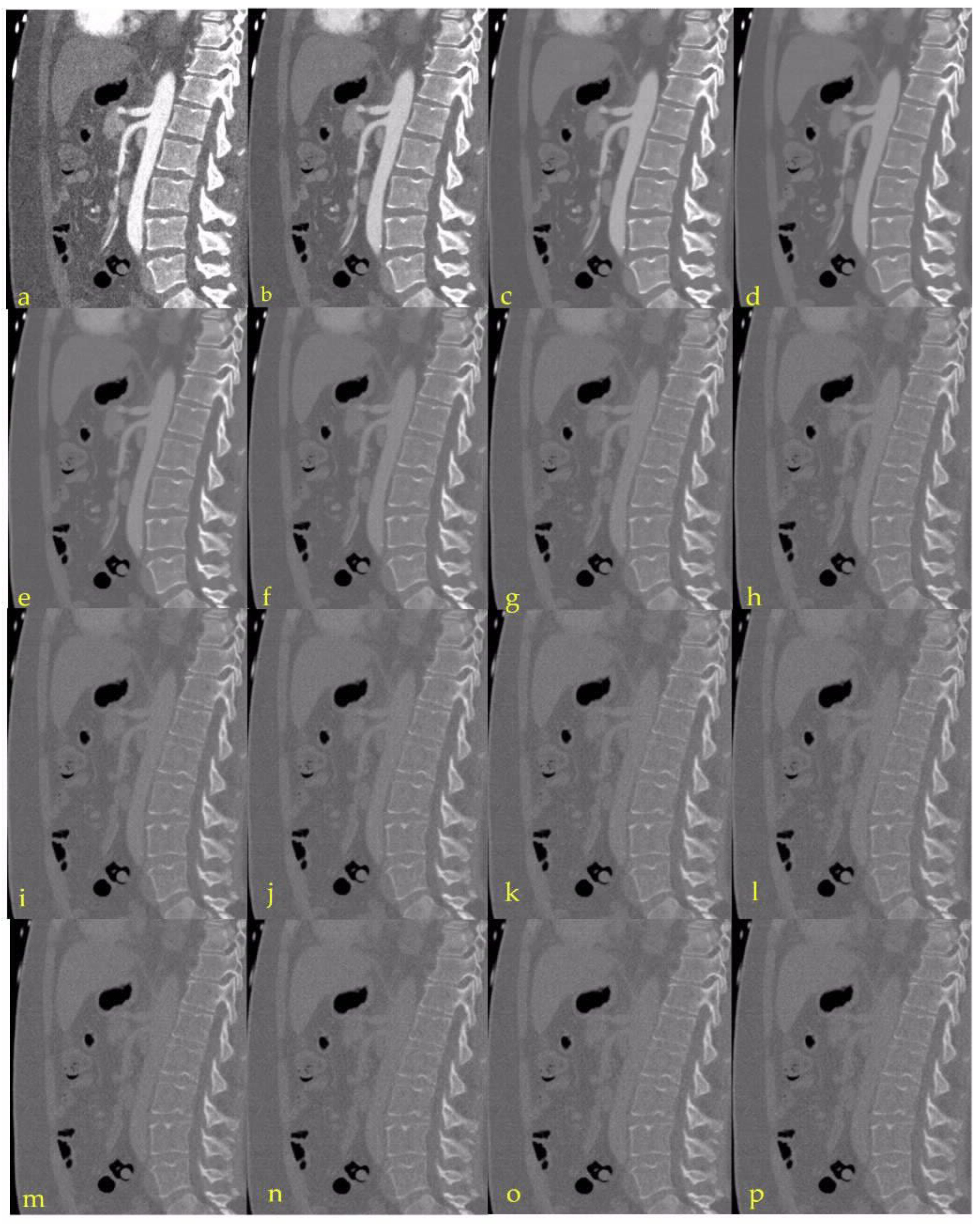Diagnostics 13 00938 g001