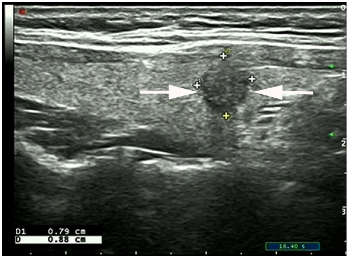 Diagnostics 13 00949 g002 Diagnostics 13 00949 g002