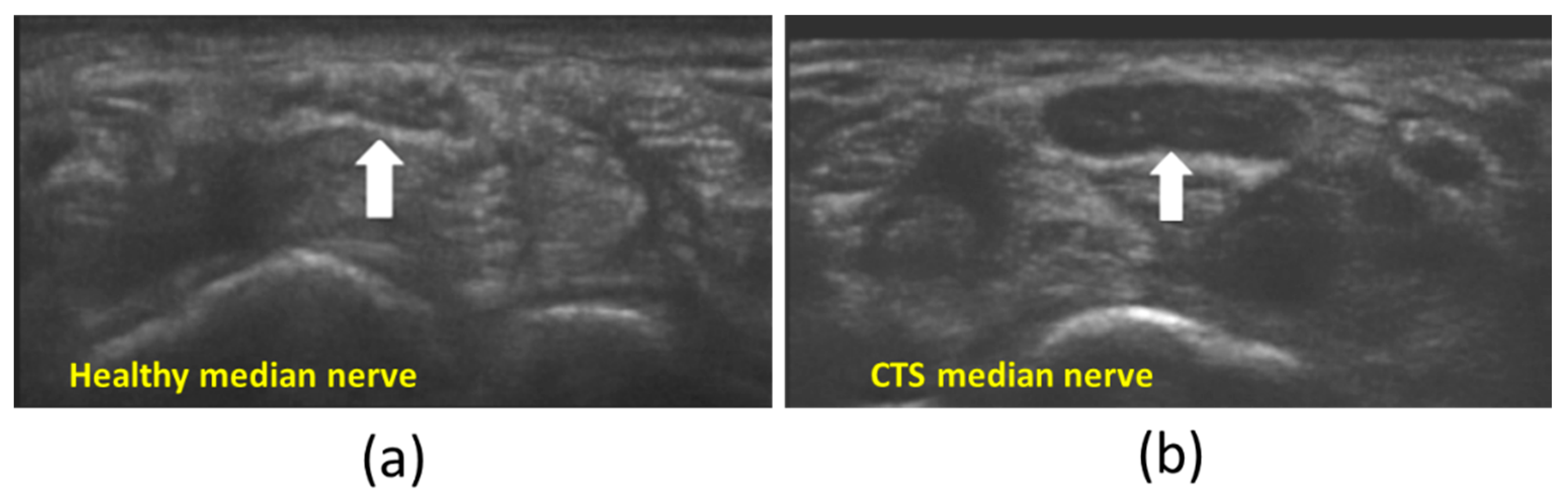 Diagnostics 13 00956 g002 Diagnostics 13 00956 g002