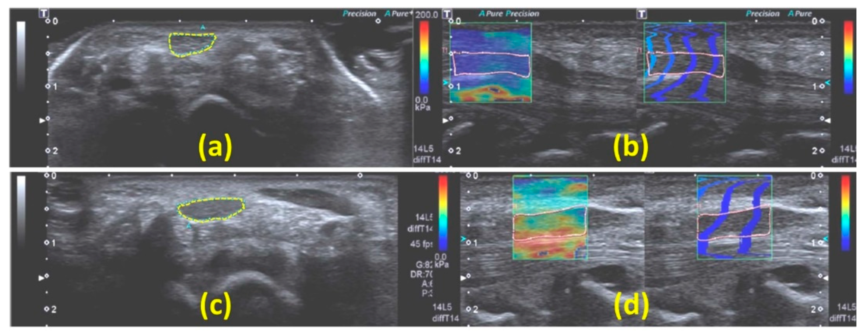 Diagnostics 13 00956 g008 Diagnostics 13 00956 g008