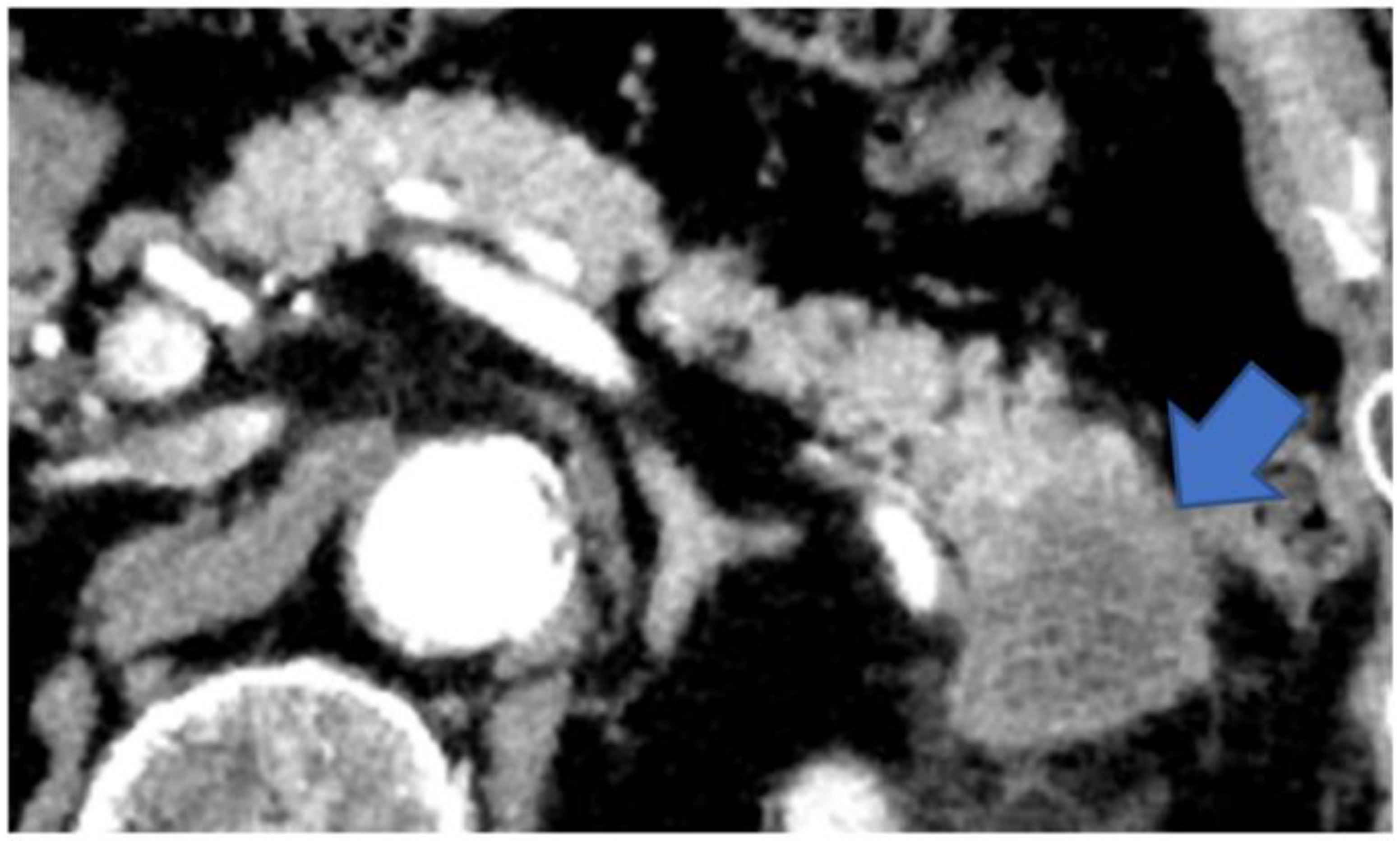 Diagnostics 13 00963 g008 Diagnostics 13 00963 g008