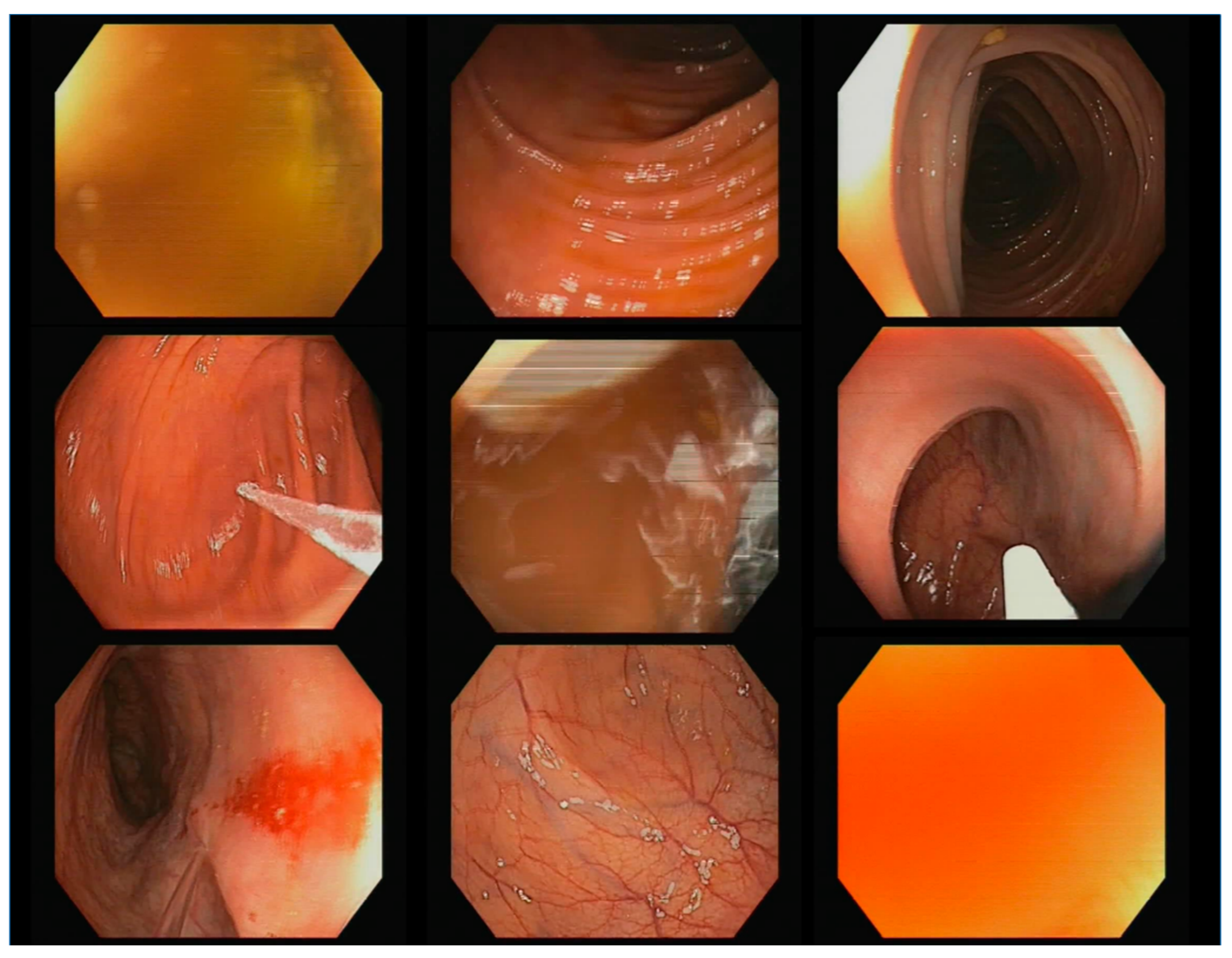 Diagnostics 13 00966 g002 Diagnostics 13 00966 g002