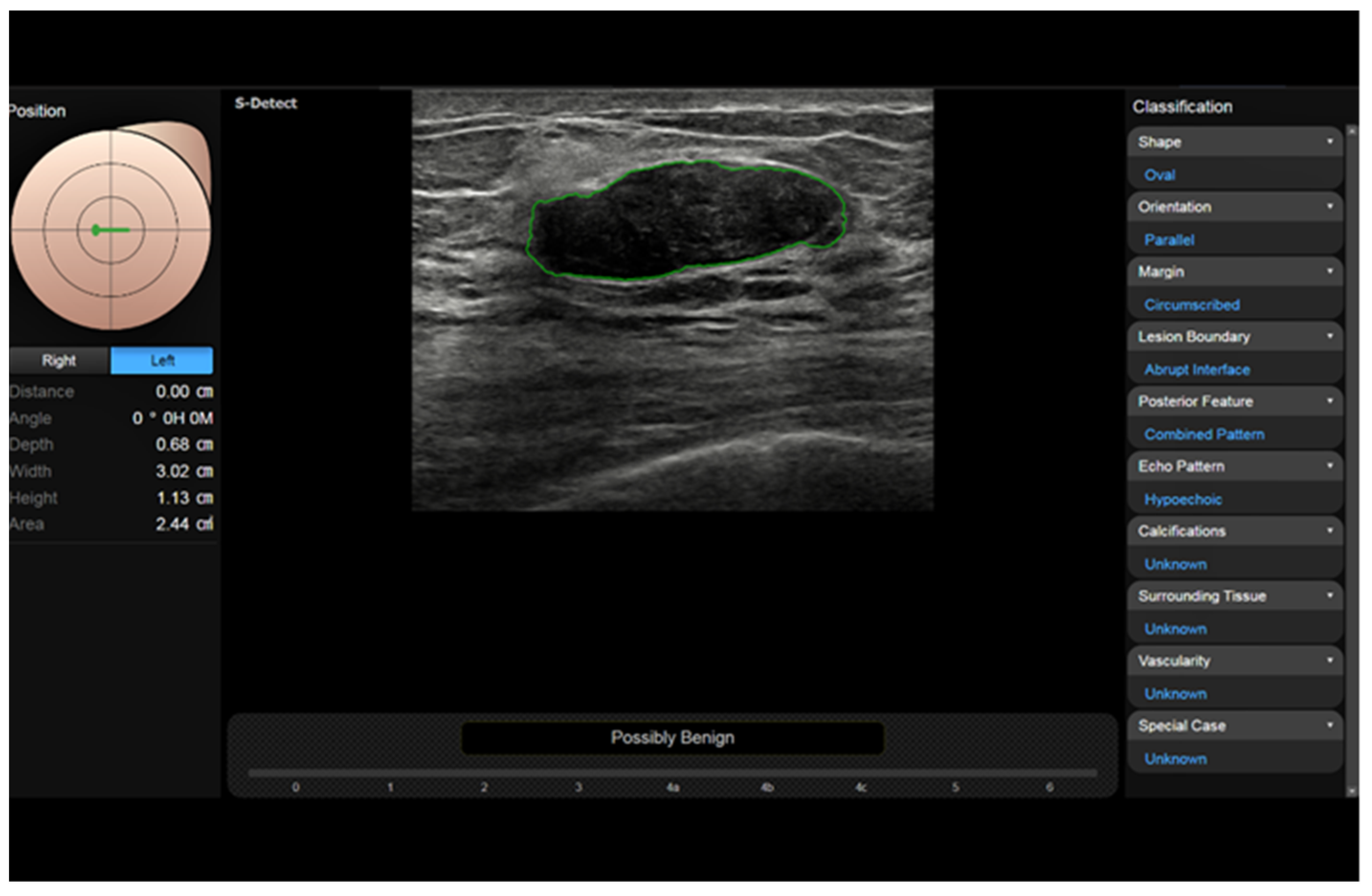 Diagnostics 13 00980 g007