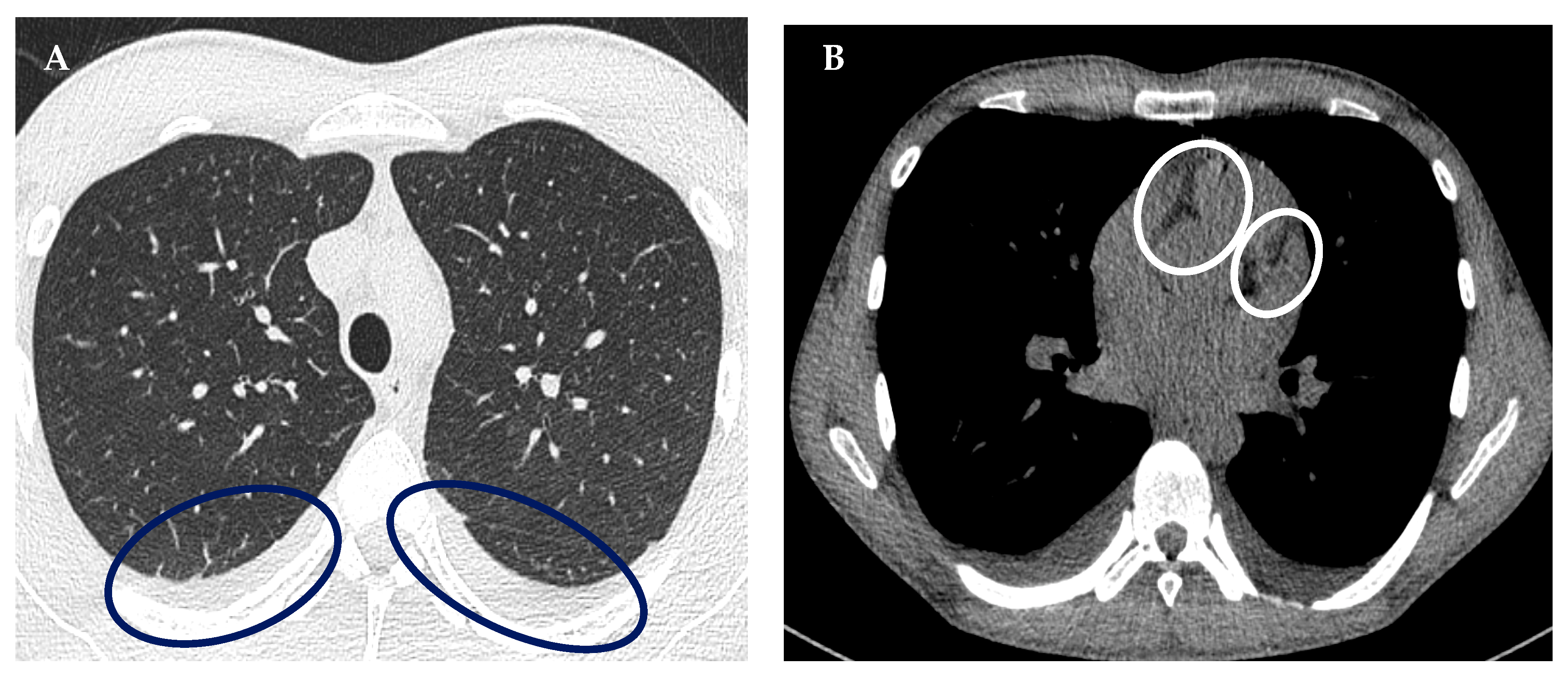 Diagnostics 13 00983 g002 Diagnostics 13 00983 g002