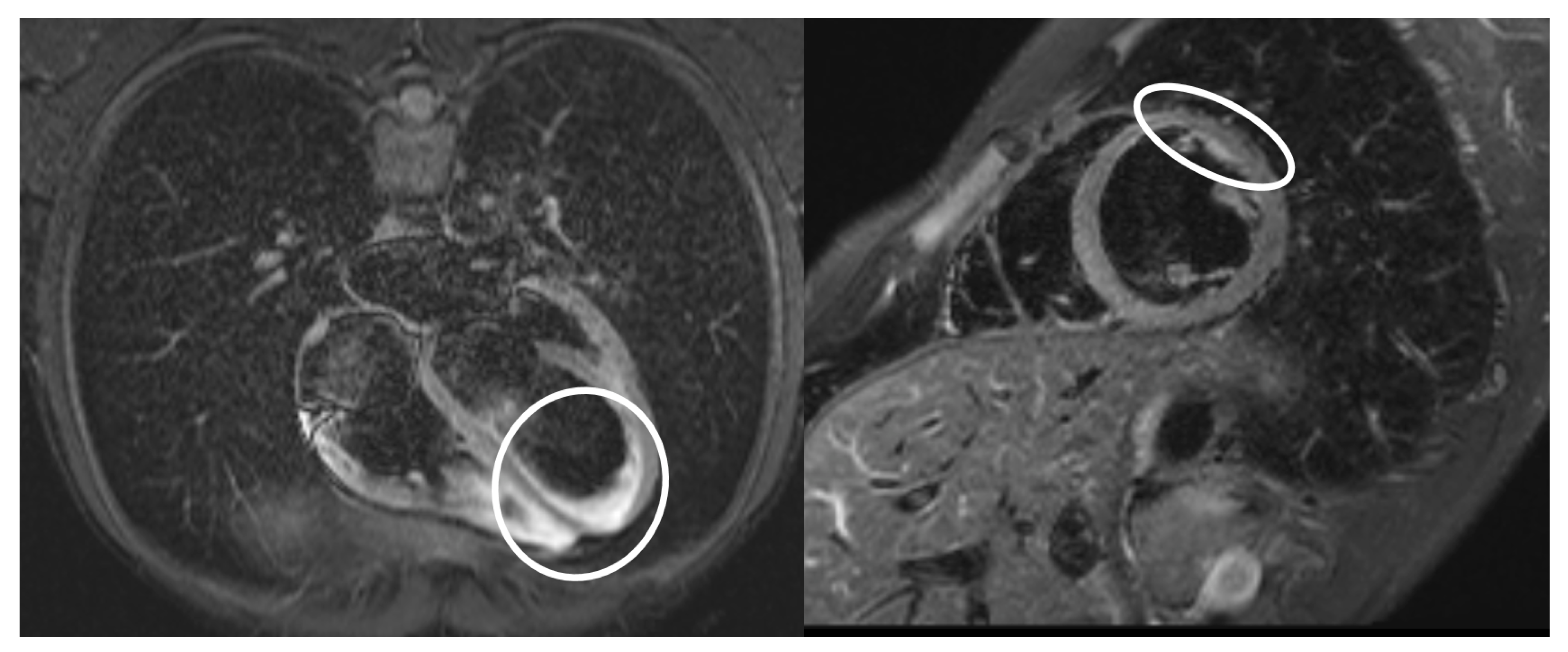 Diagnostics 13 00983 g004 Diagnostics 13 00983 g004