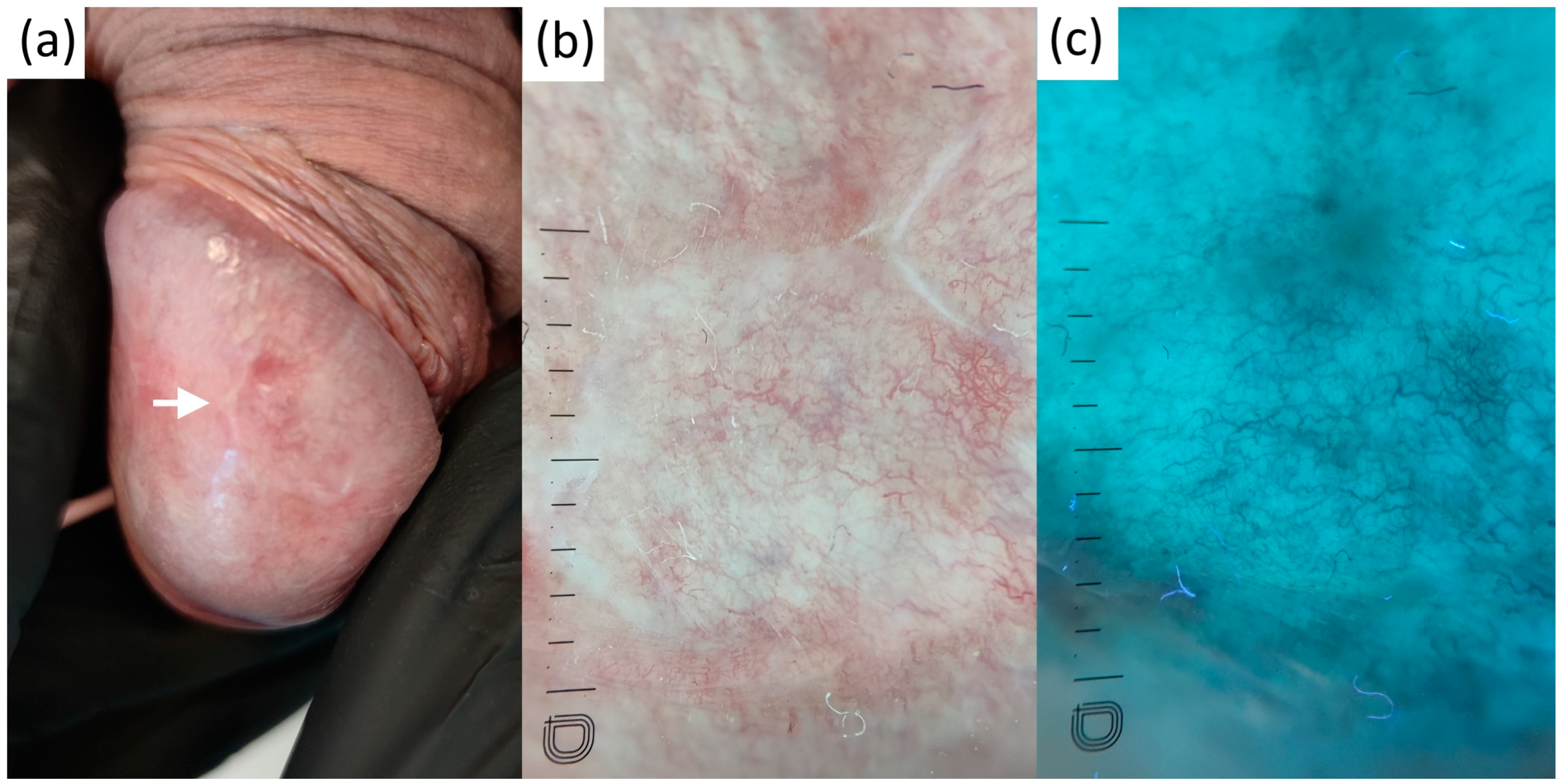 Diagnostics 13 00985 g003 Diagnostics 13 00985 g003