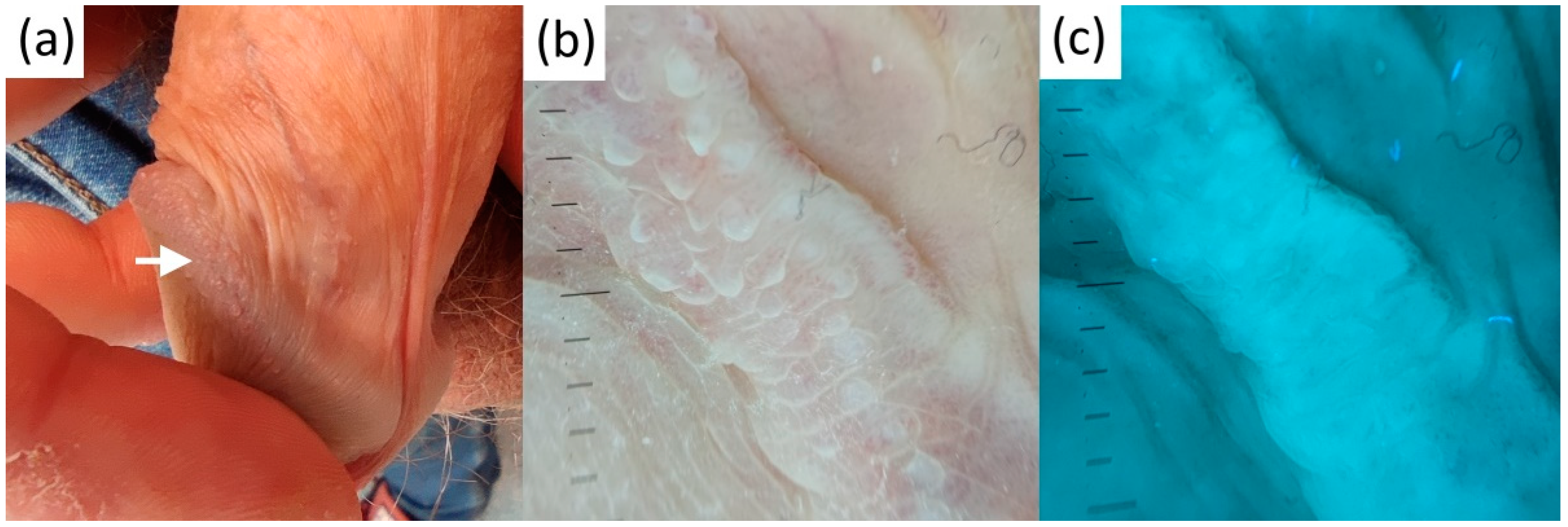 Diagnostics 13 00985 g006 Diagnostics 13 00985 g006