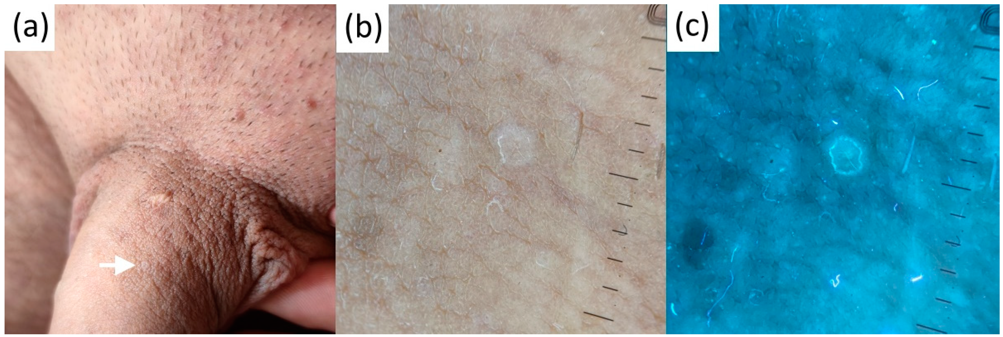 Diagnostics 13 00985 g007 Diagnostics 13 00985 g007