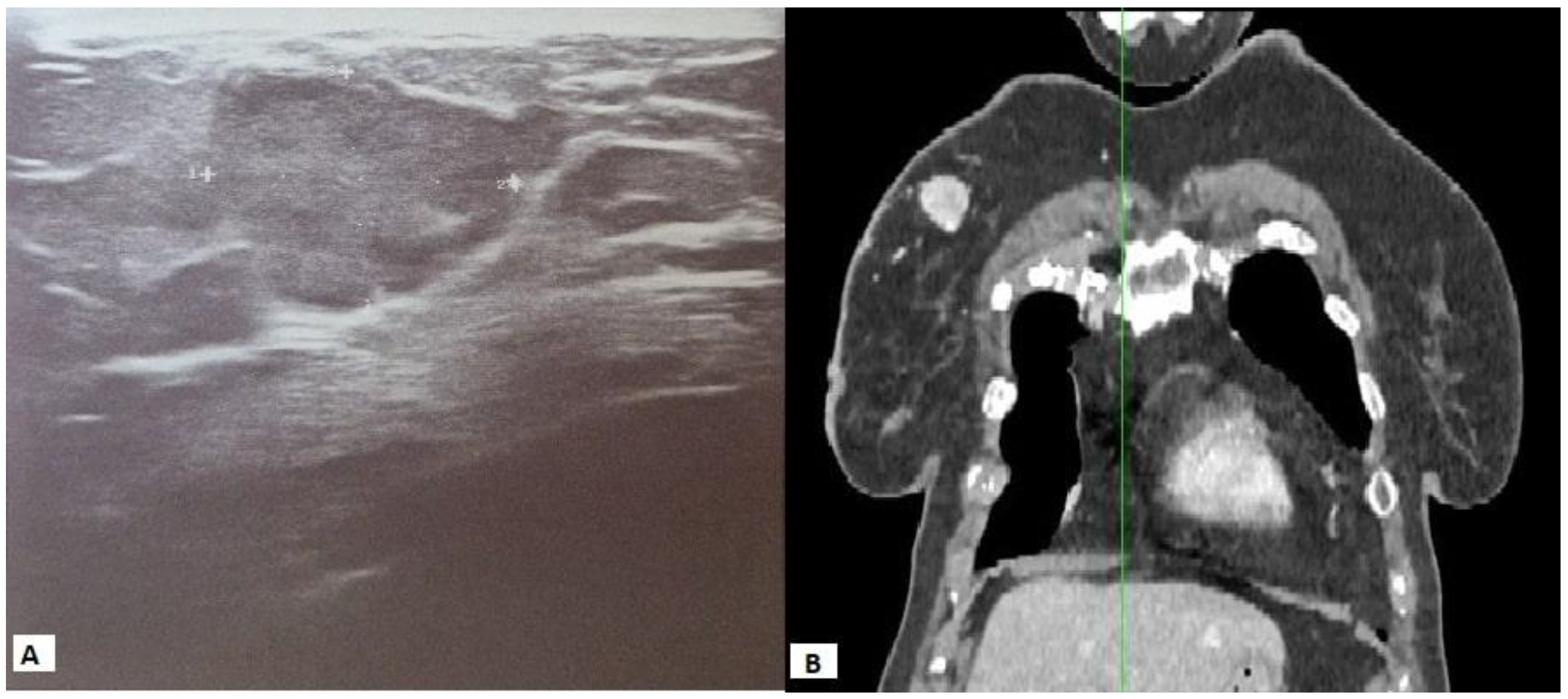 Diagnostics 13 00991 g002