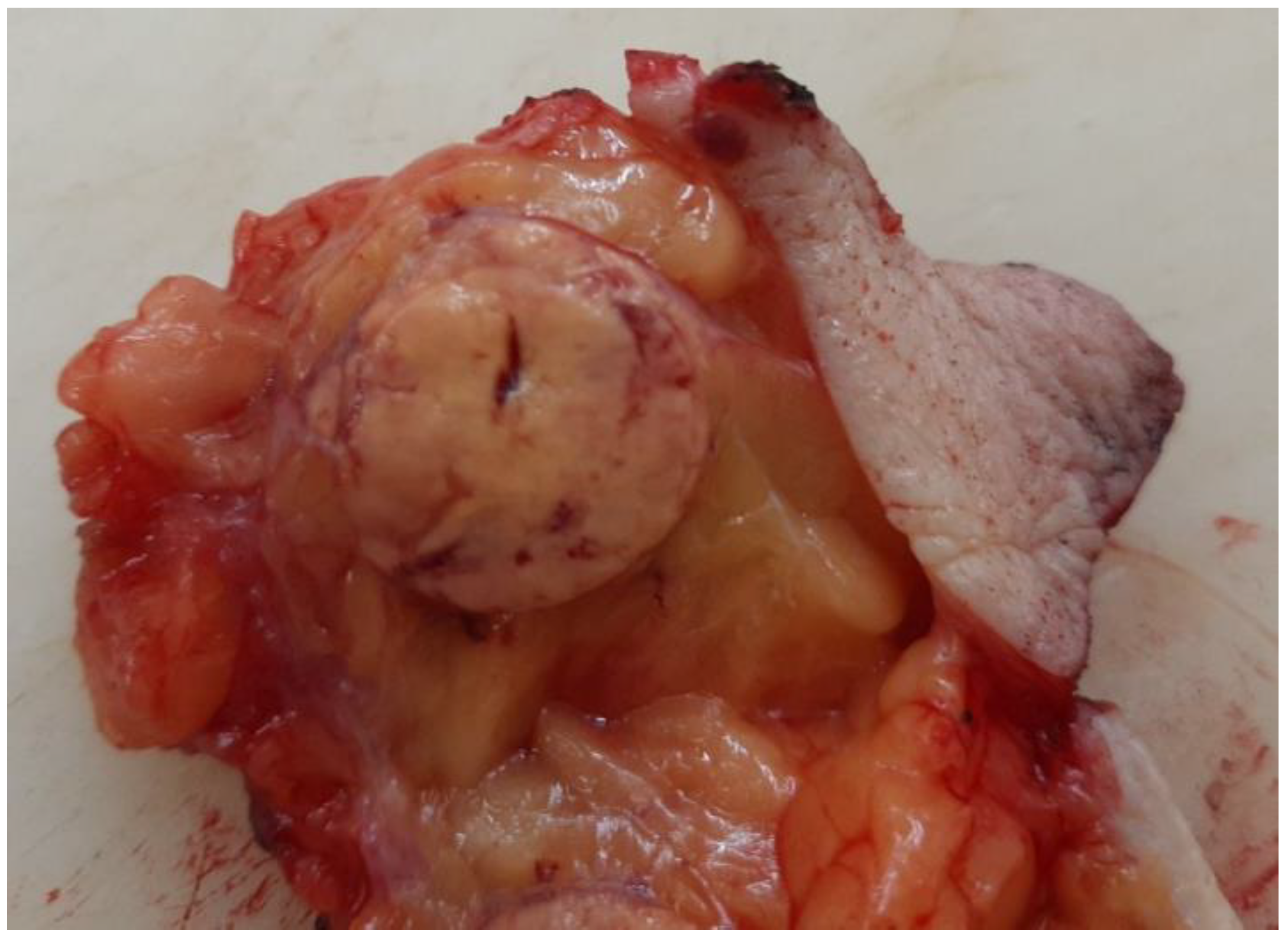 Diagnostics 13 00991 g003