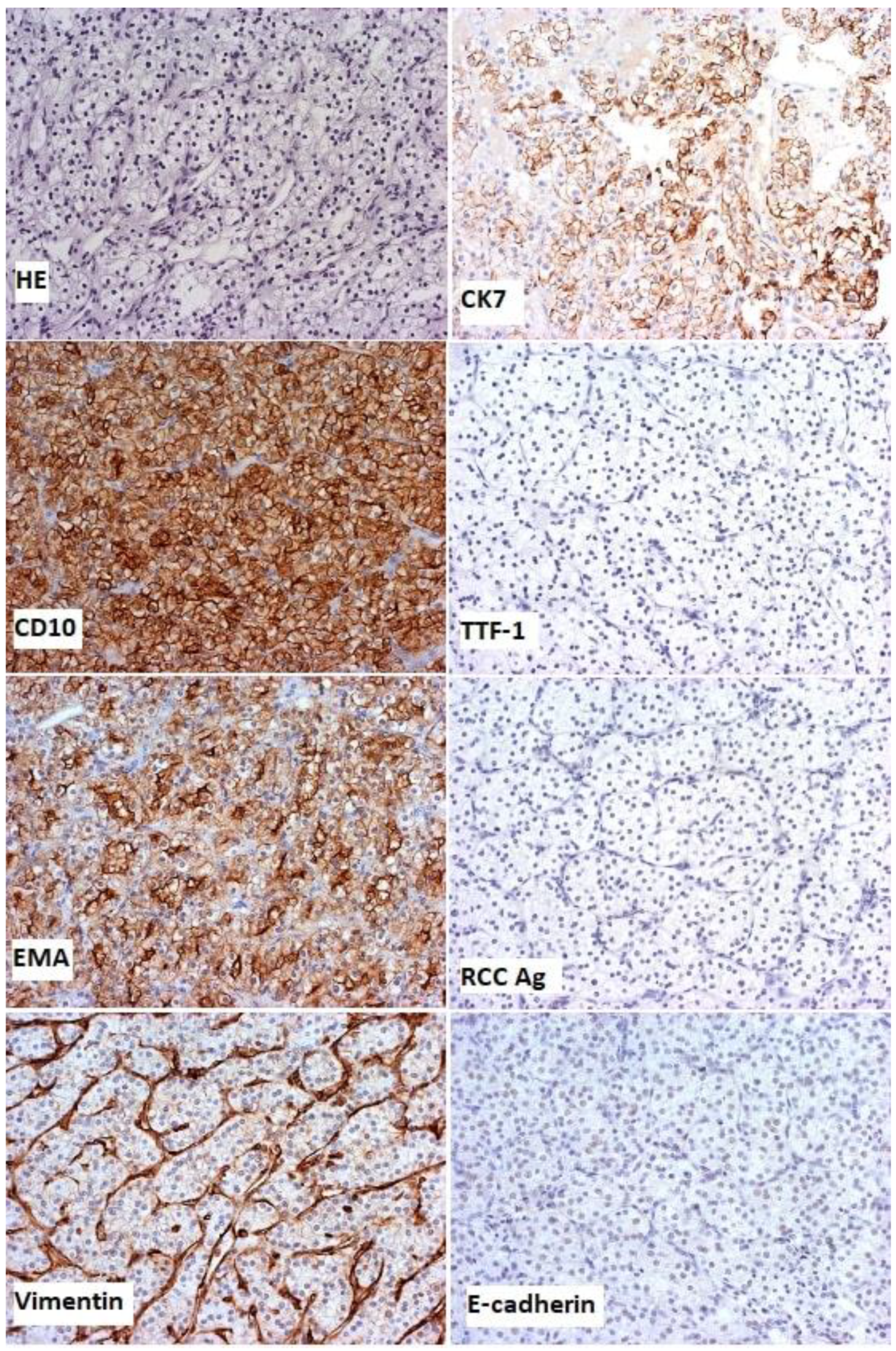 Diagnostics 13 00991 g004