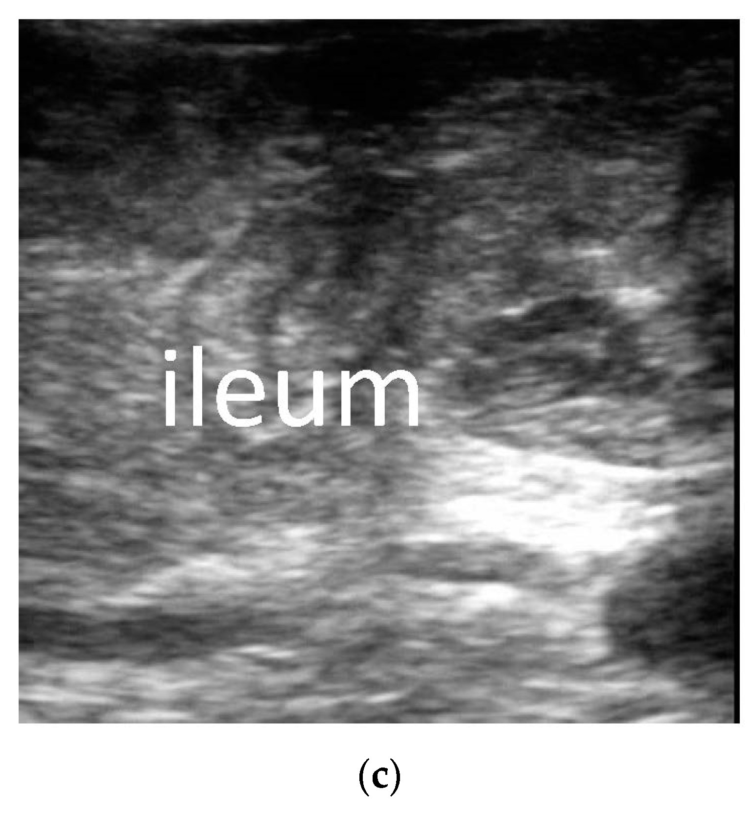 Diagnostics 13 00995 g003b Diagnostics 13 00995 g003b