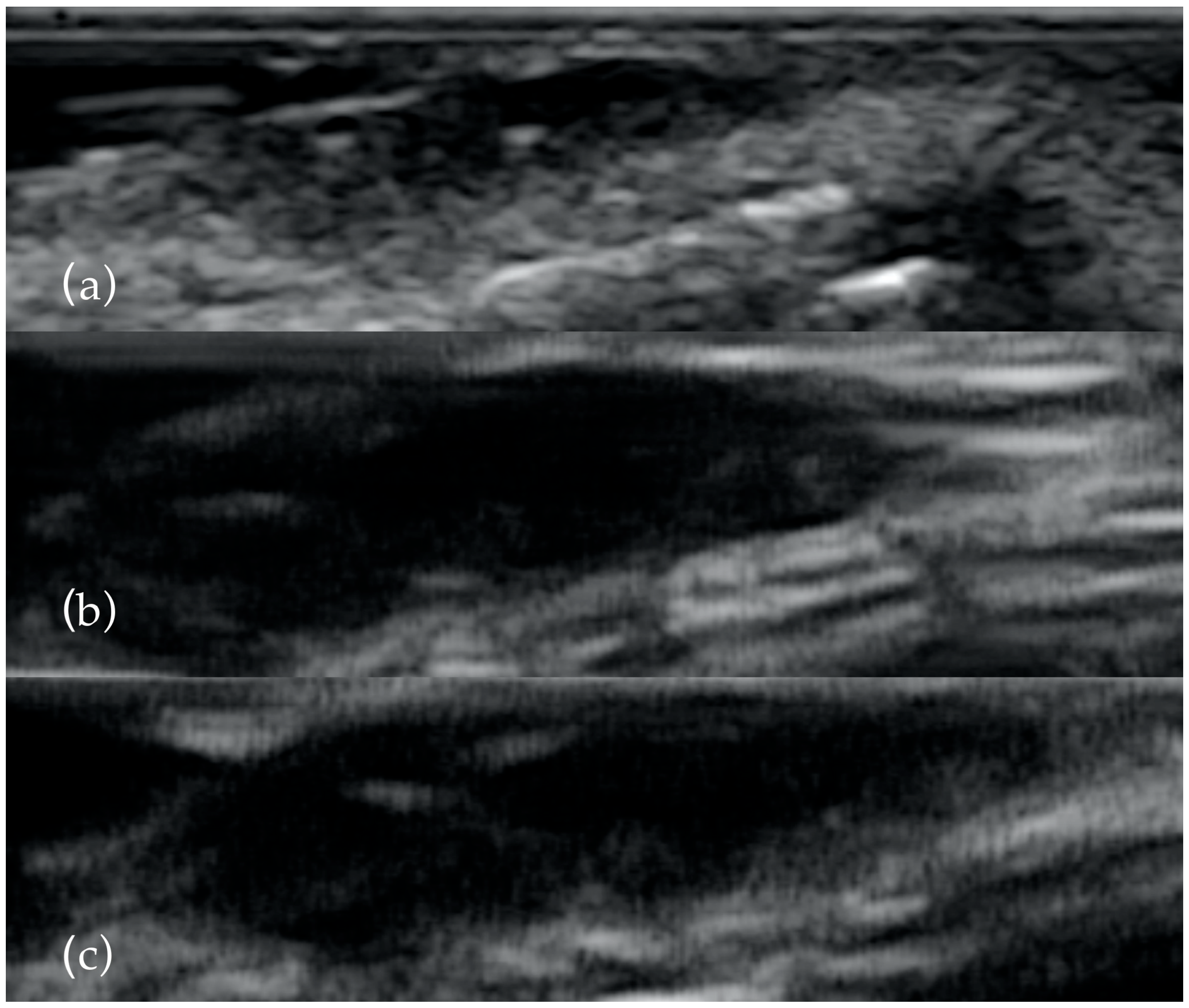 Diagnostics 13 01002 g001