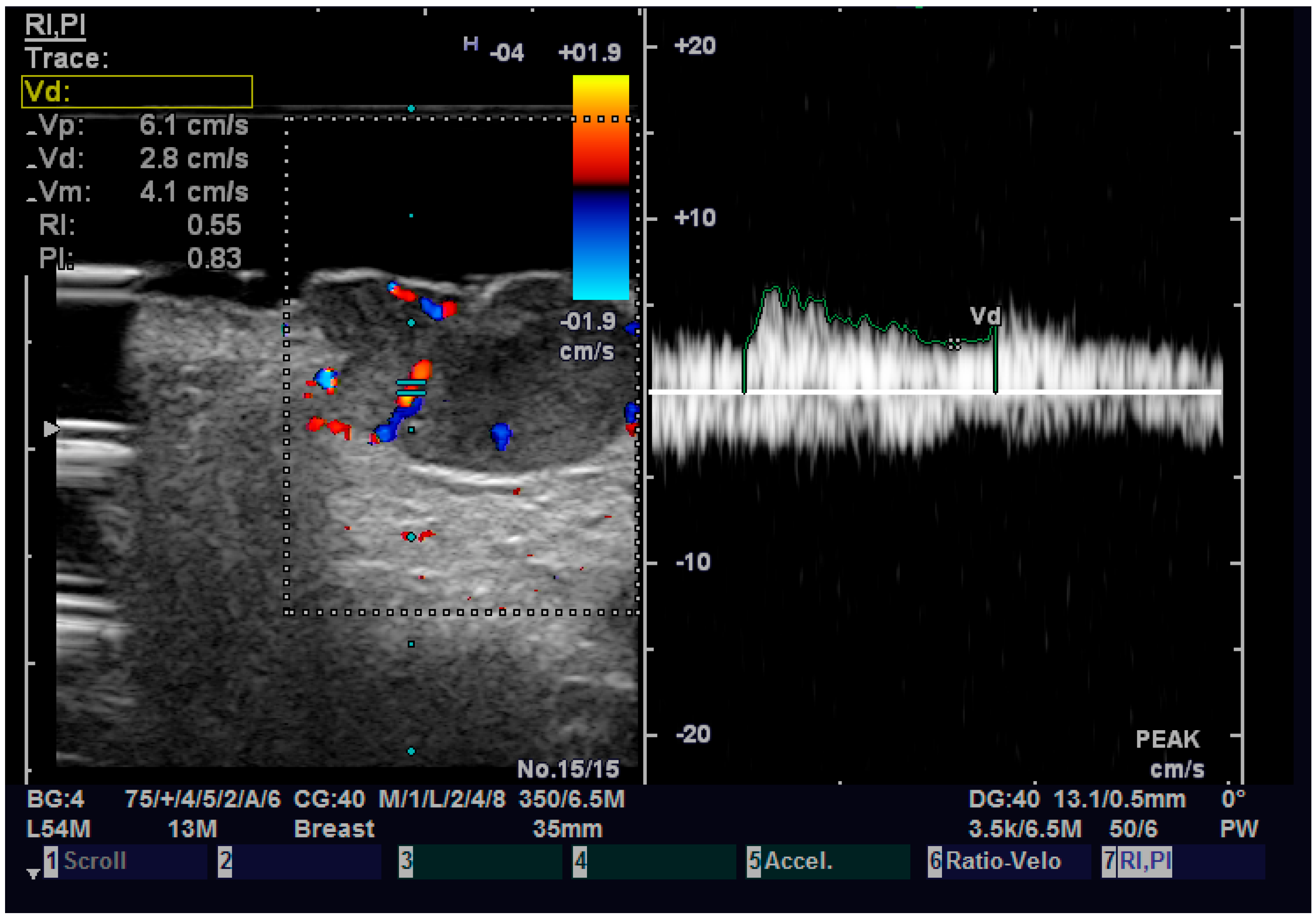 Diagnostics 13 01002 g007