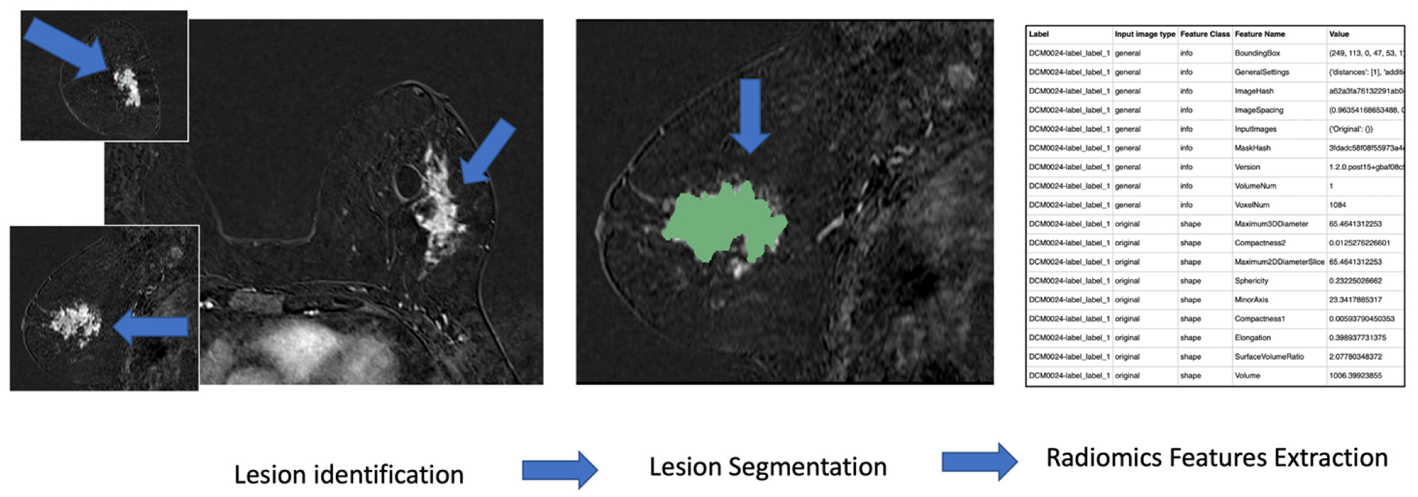 Diagnostics 13 01007 g001