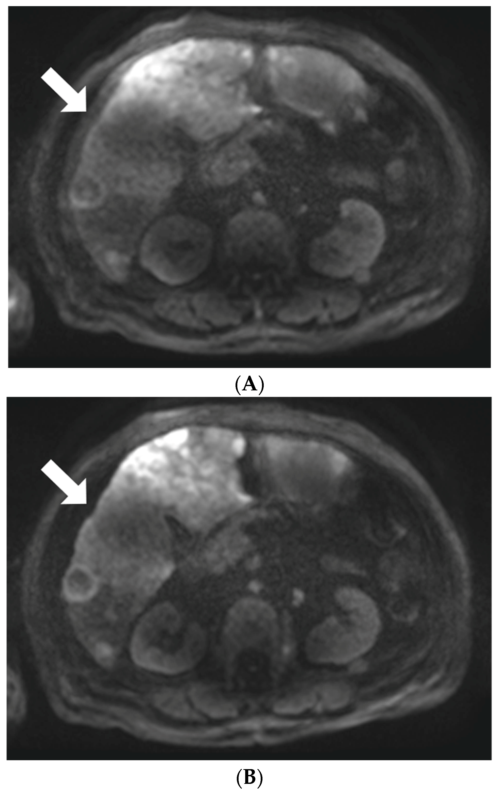 Diagnostics 13 01008 g002 Diagnostics 13 01008 g002